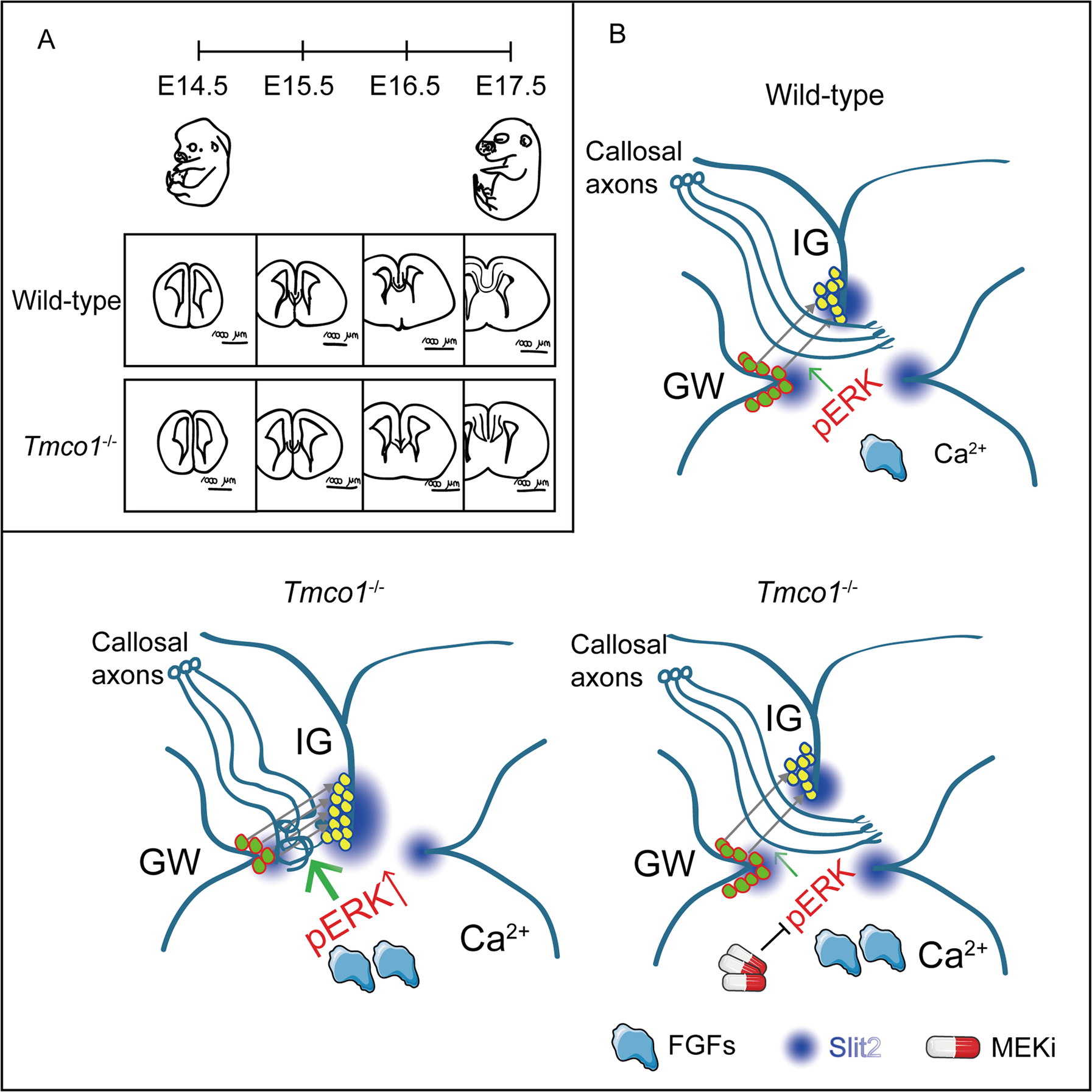 Fig. 6: Model for TMCO1 deficiency-induced agenesis of corpus callosum (AgCC) and MEKi-restored corpus callosum (CC) formation.