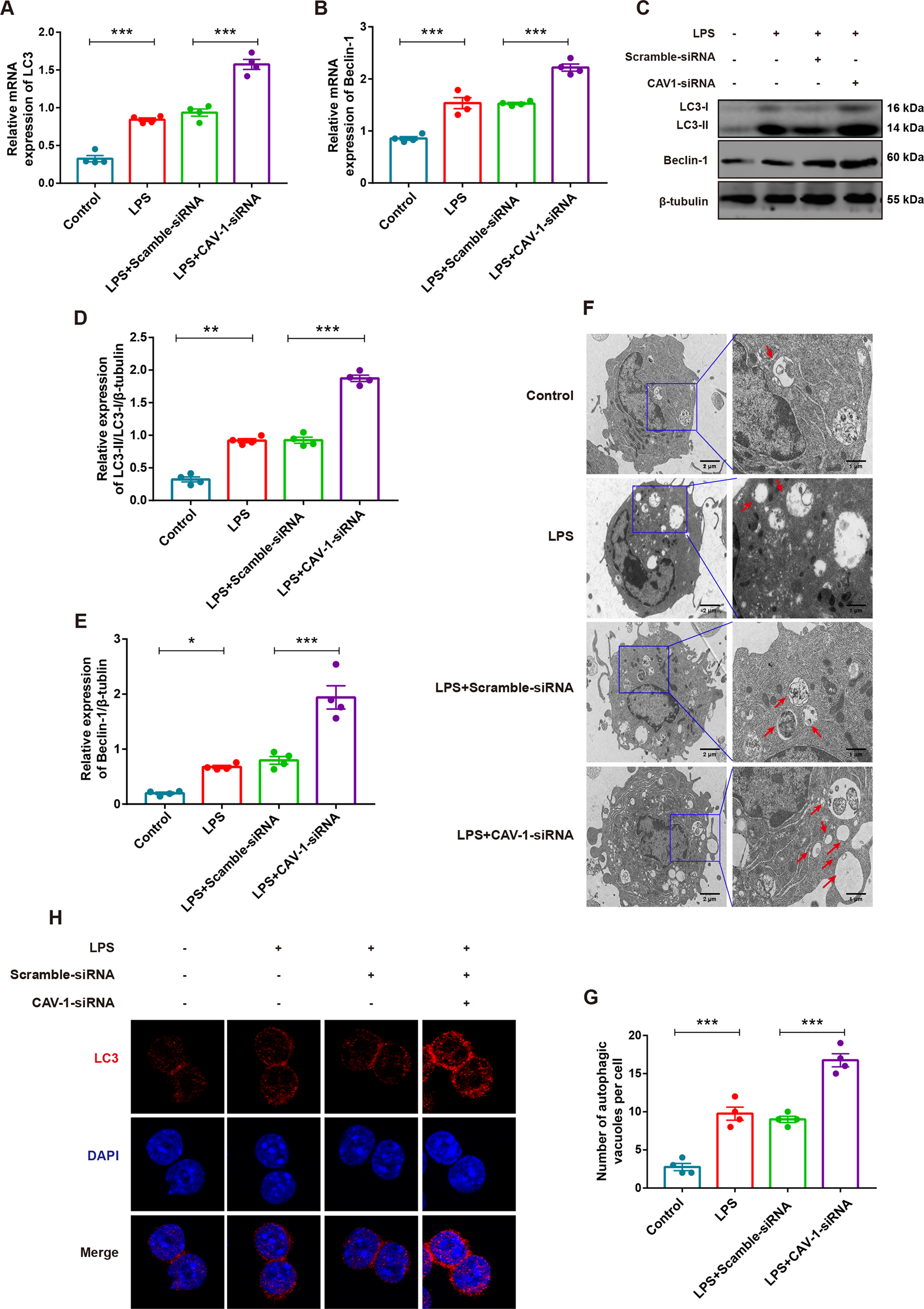 Fig. 6: Knockdown of CAV-1 activated autophagy in BMDMs.