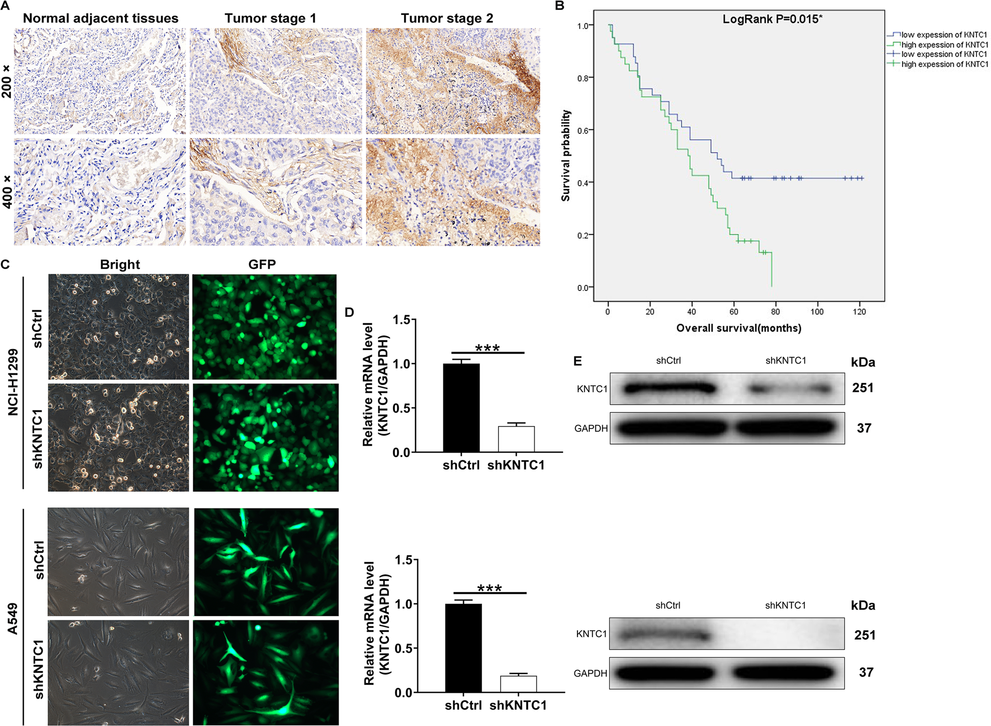 shRNA‑mediated knockdown of KNTC1 inhibits non-small-cell lung cancer  through regulating PSMB8 | Cell Death & Disease
