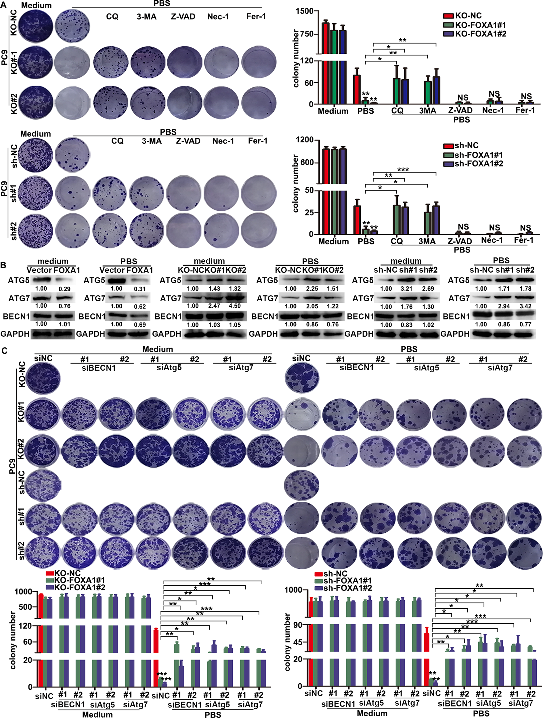 Fig. 3: Loss of FOXA1 promoted autophagic cell death in LUAD cells under metabolic stress conditions.