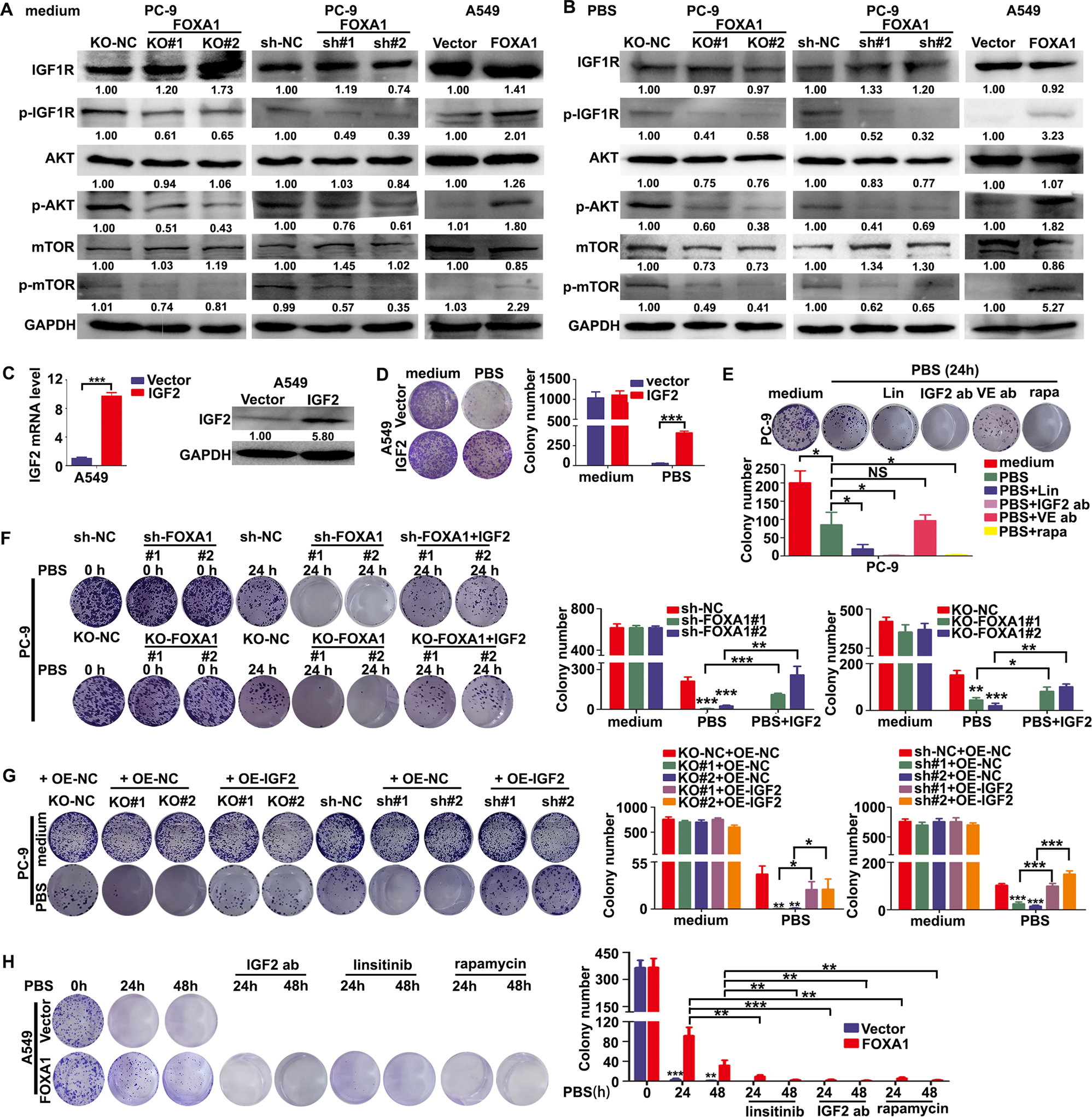 Fig. 5: FOXA1 prevented metabolic stress-induced autophagic cell death via activation of IGF2/IGF1R/mTORC1 signaling.