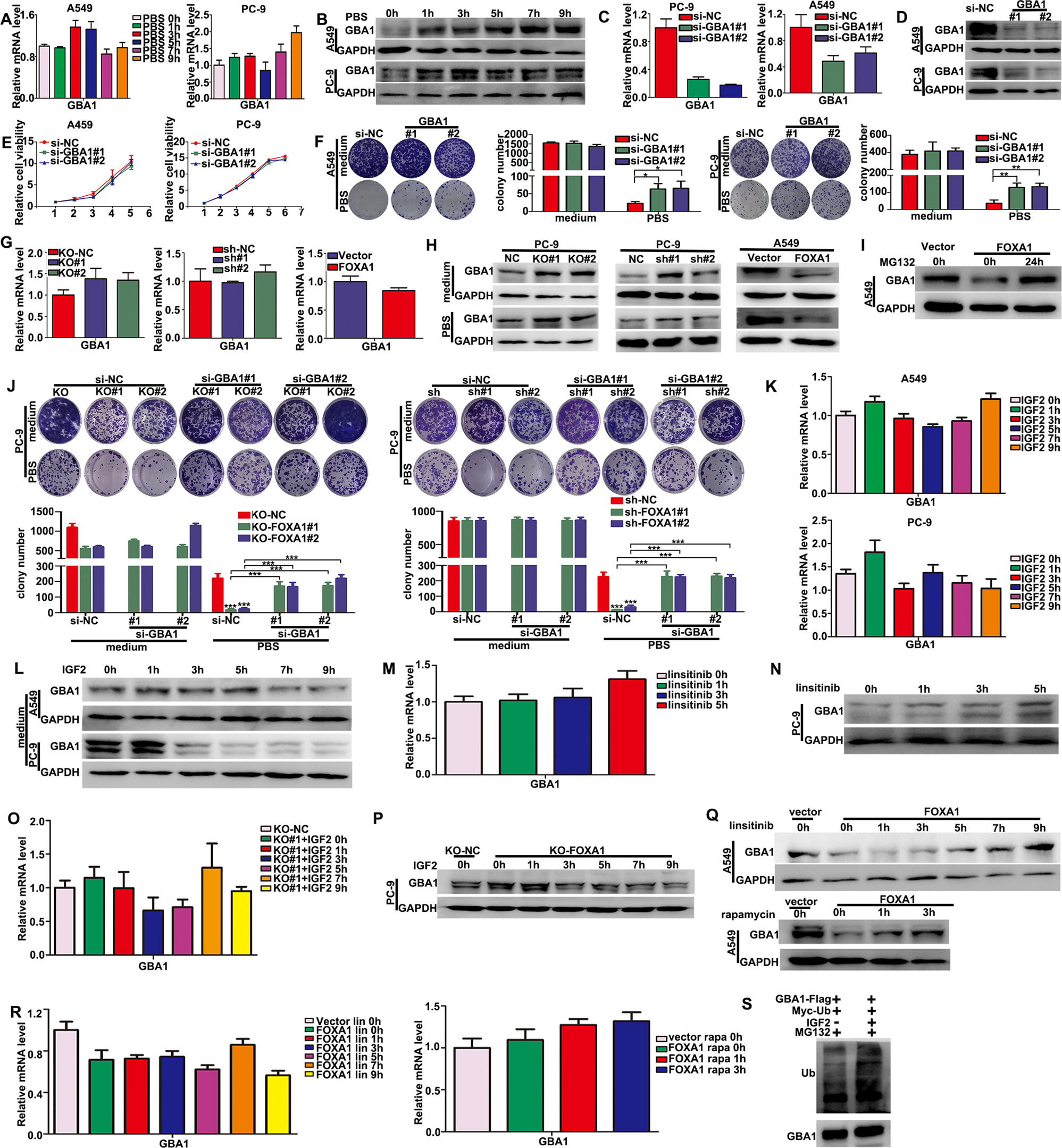 Fig. 6: Repression of GBA1 protein by IGF2 signaling contributed to the survival advantage of LUAD cells conferred by FOXA1 under metabolic stress conditions.