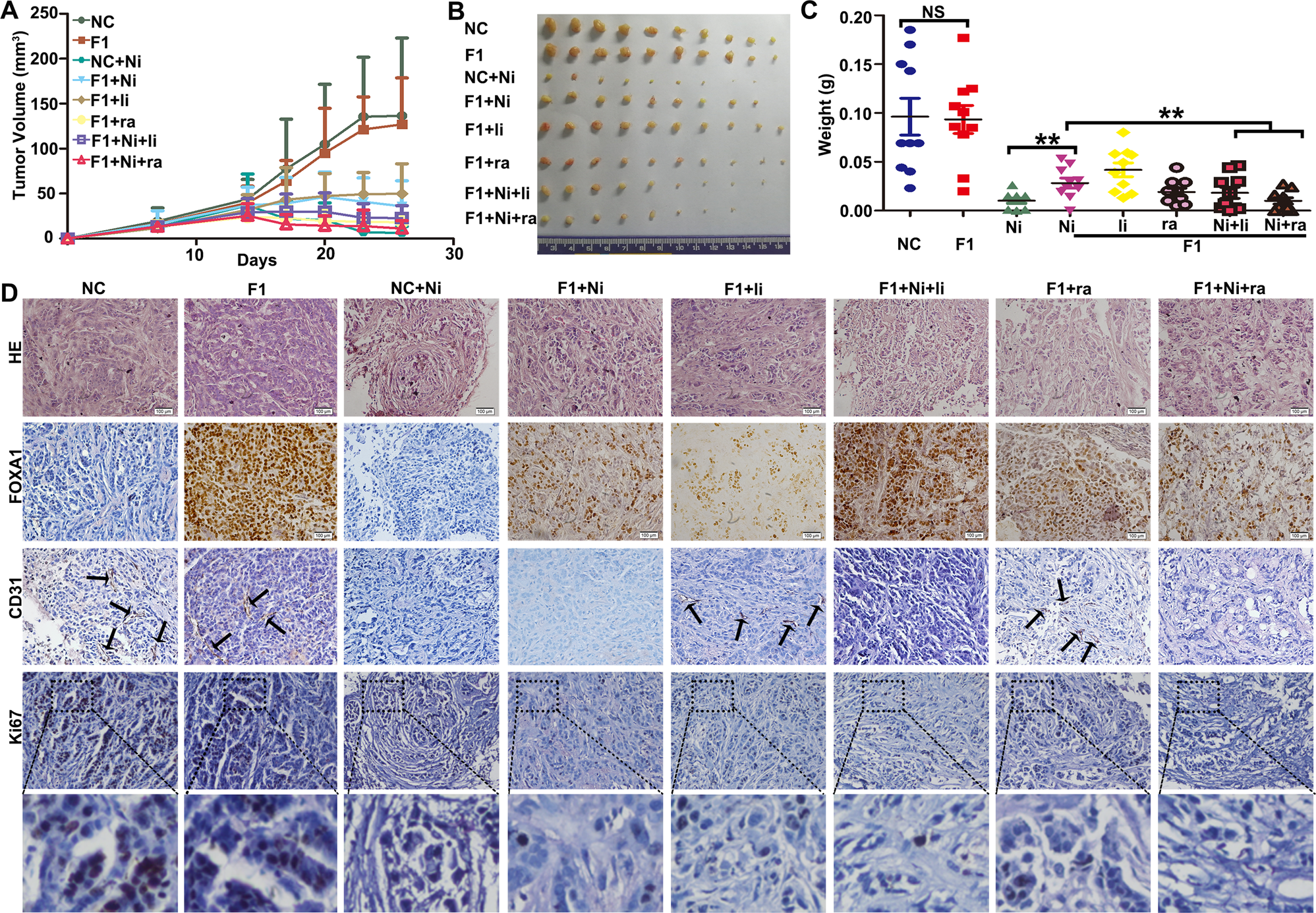 Fig. 7: FOXA1 expression reduced the efficacy of nintedanib against xenograft tumors derived from A549 cells.