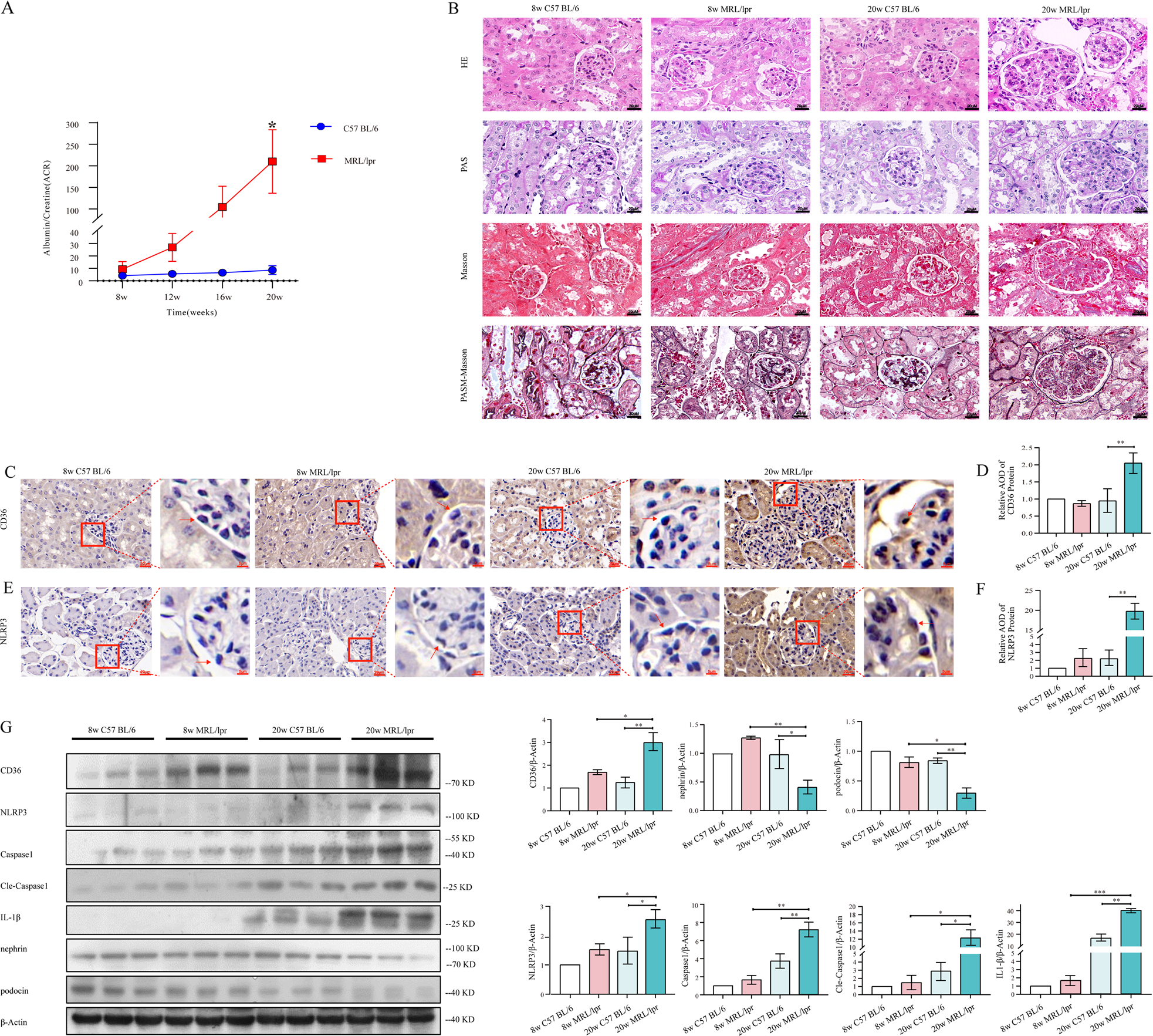 Fig. 2: The expression of CD36 and NLRP3 inflammasome was upregulated in MRL/lpr mice with renal impairment.