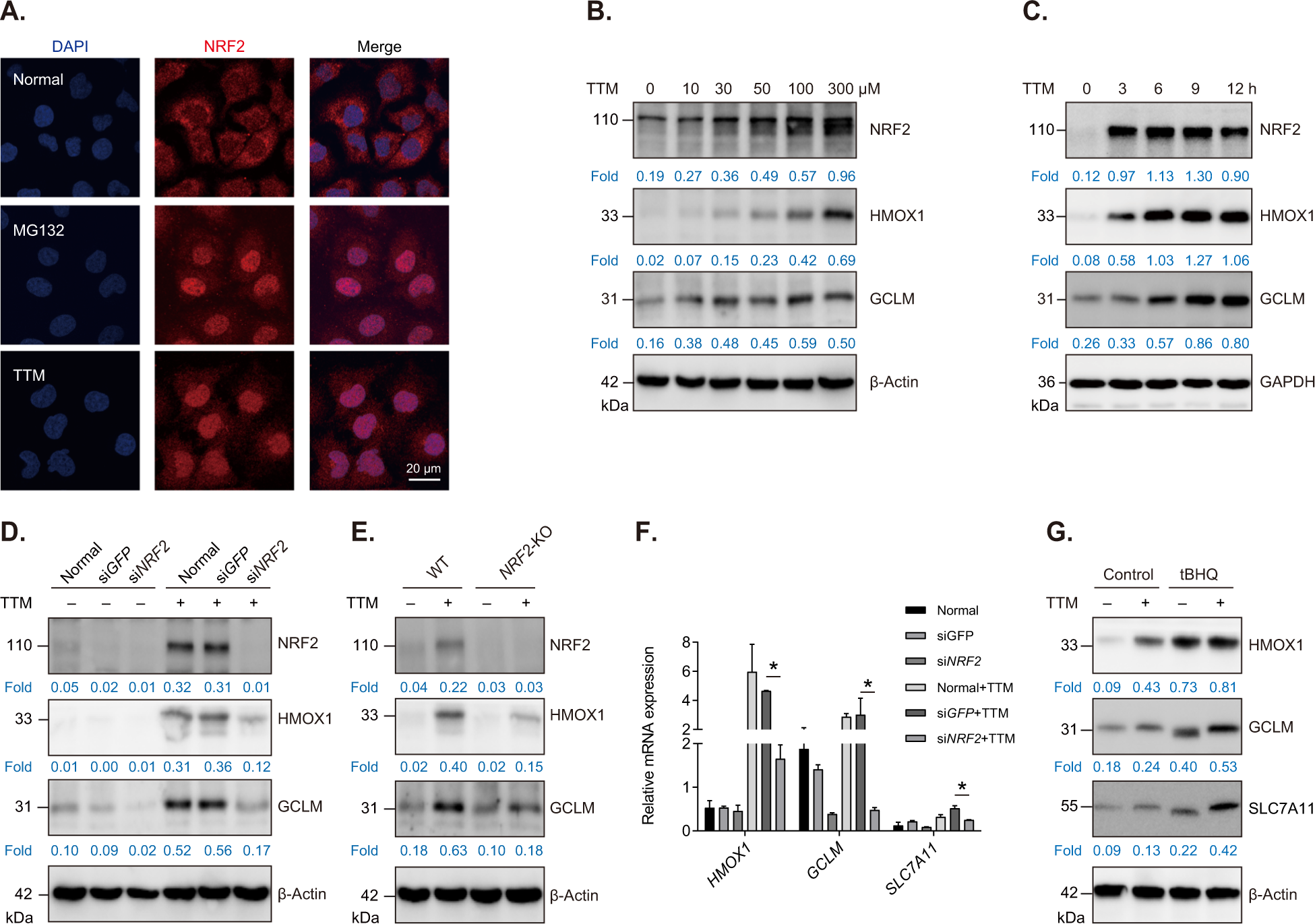 Ammonium tetrathiomolybdate triggers autophagy-dependent NRF2 activation in  vascular endothelial cells | Cell Death & Disease