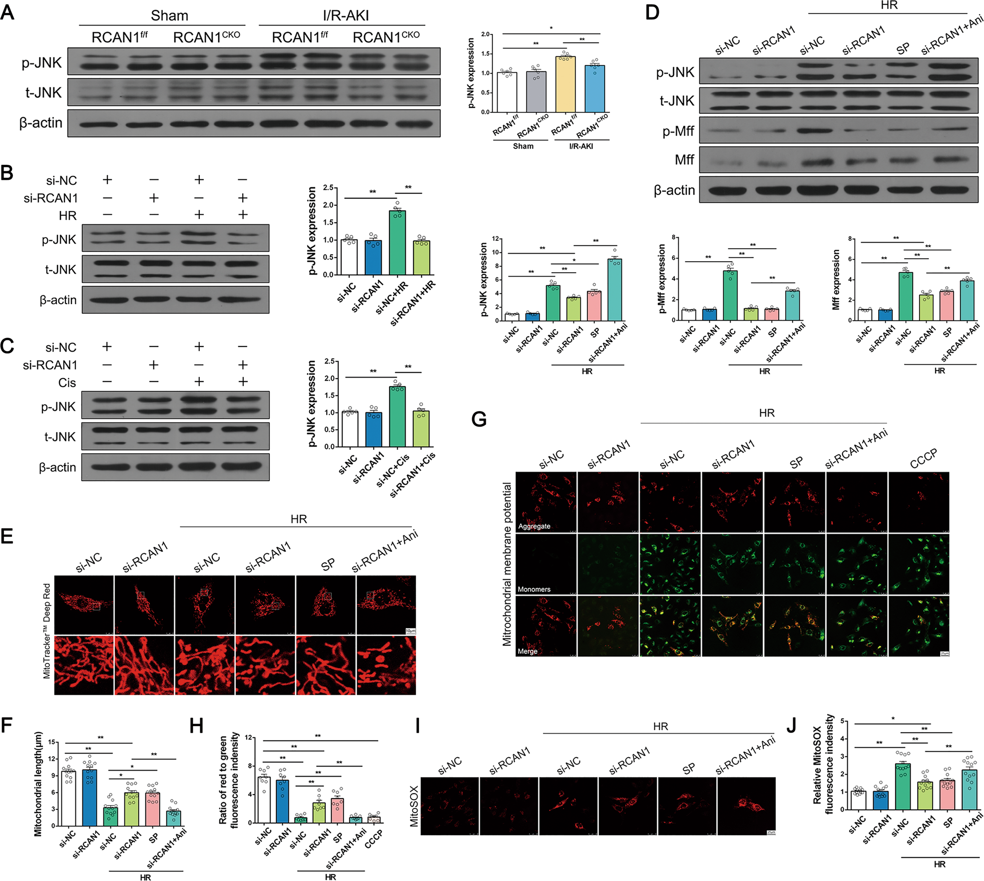 Fig. 5: RCAN1-induced mitochondrial dysfunction via the JNK/Mff pathway.