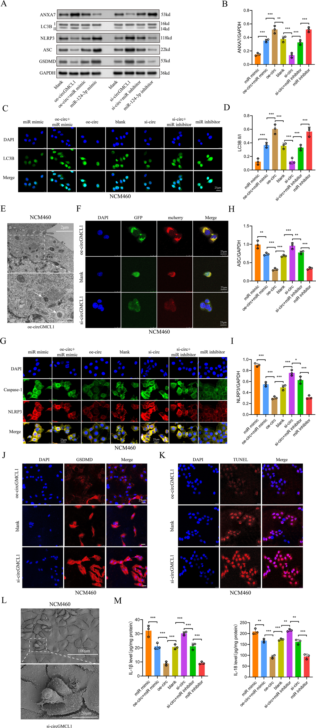 Fig. 5: Biological functions of circGMCL1 in epithelial cells.
