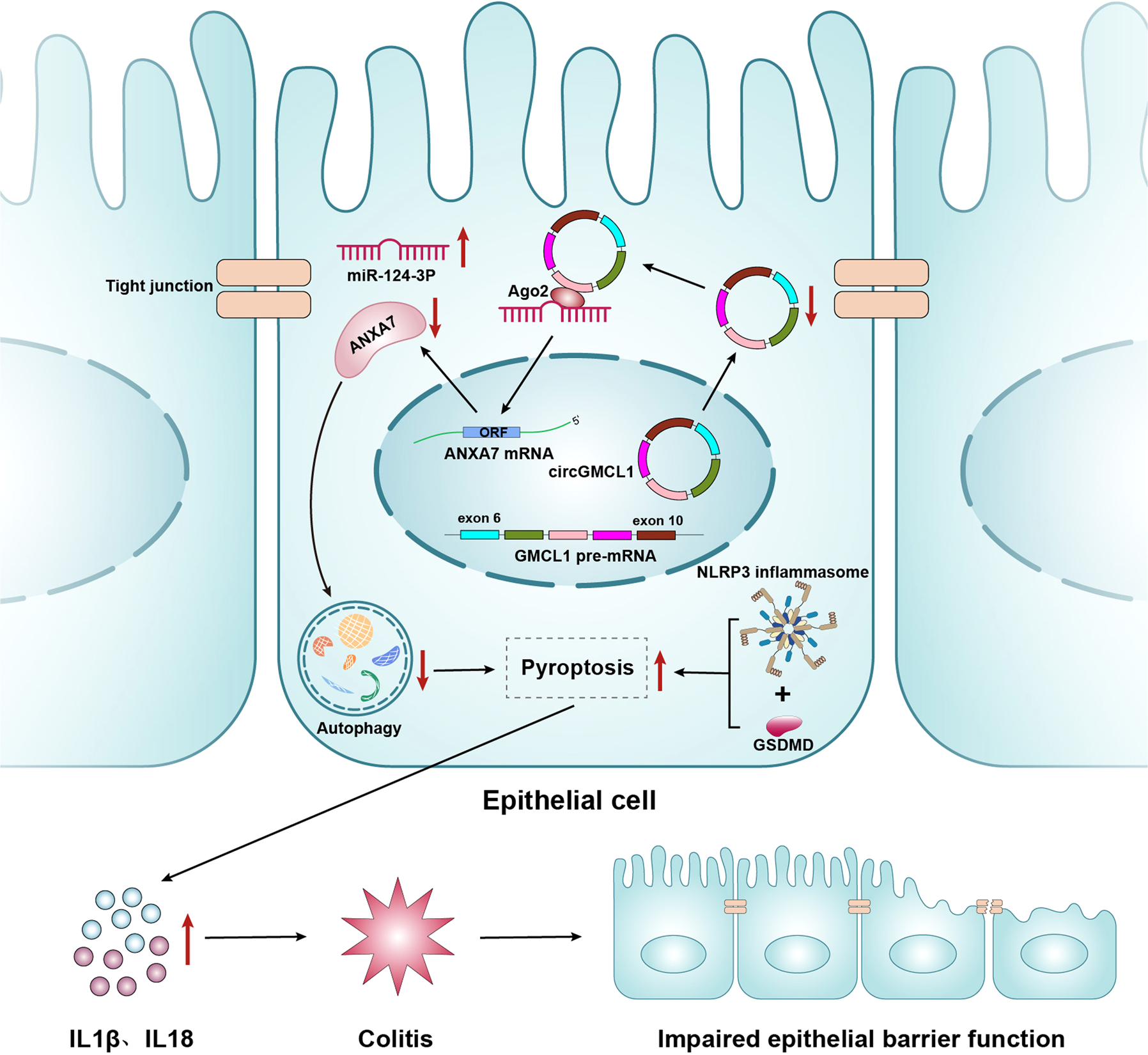 Fig. 8: A schematic diagram of the biological function of circGMCL1 in Crohn’s colitis.