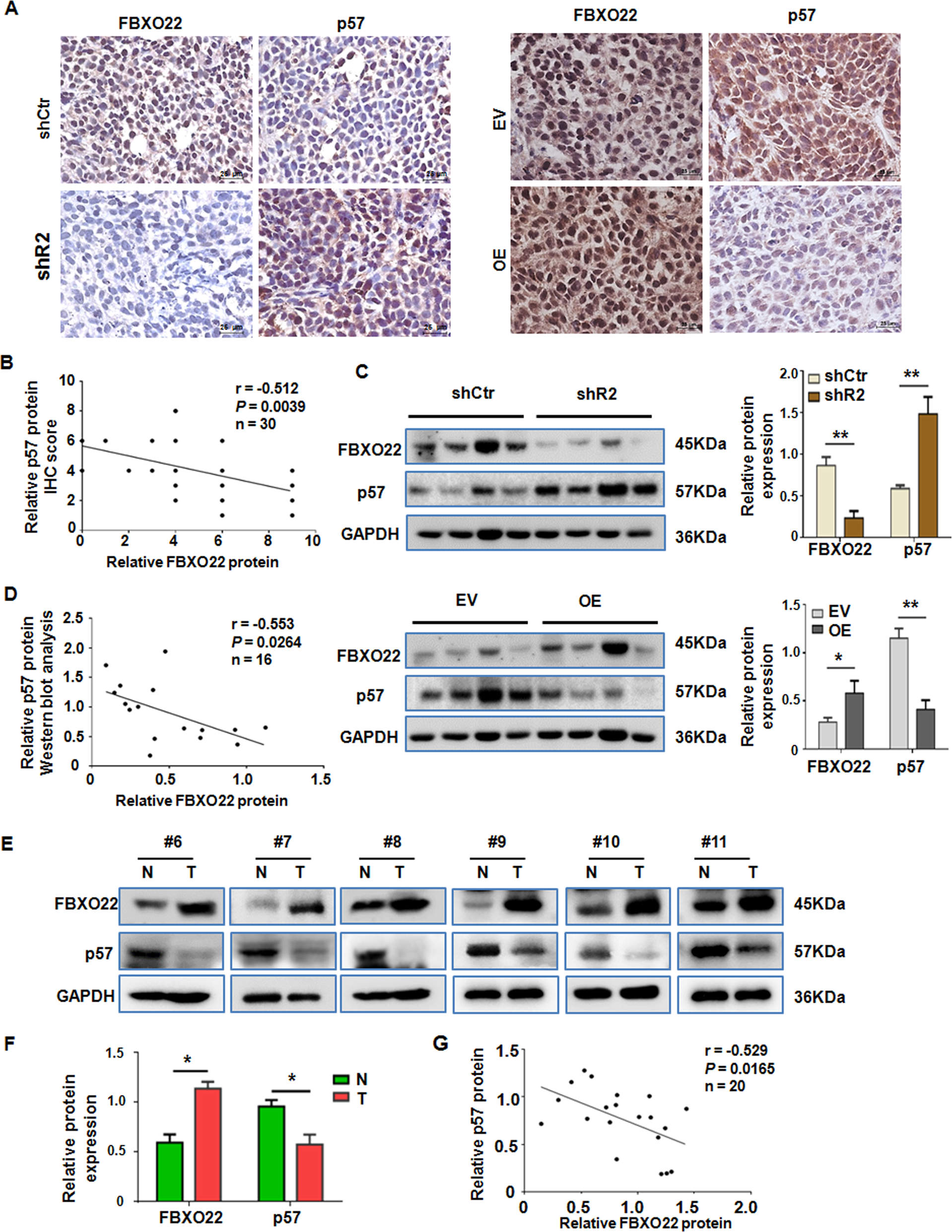 Fig. 8: FBXO22 is negatively associated with p57Kip2 expression in xenograft and clinical tumor tissues.