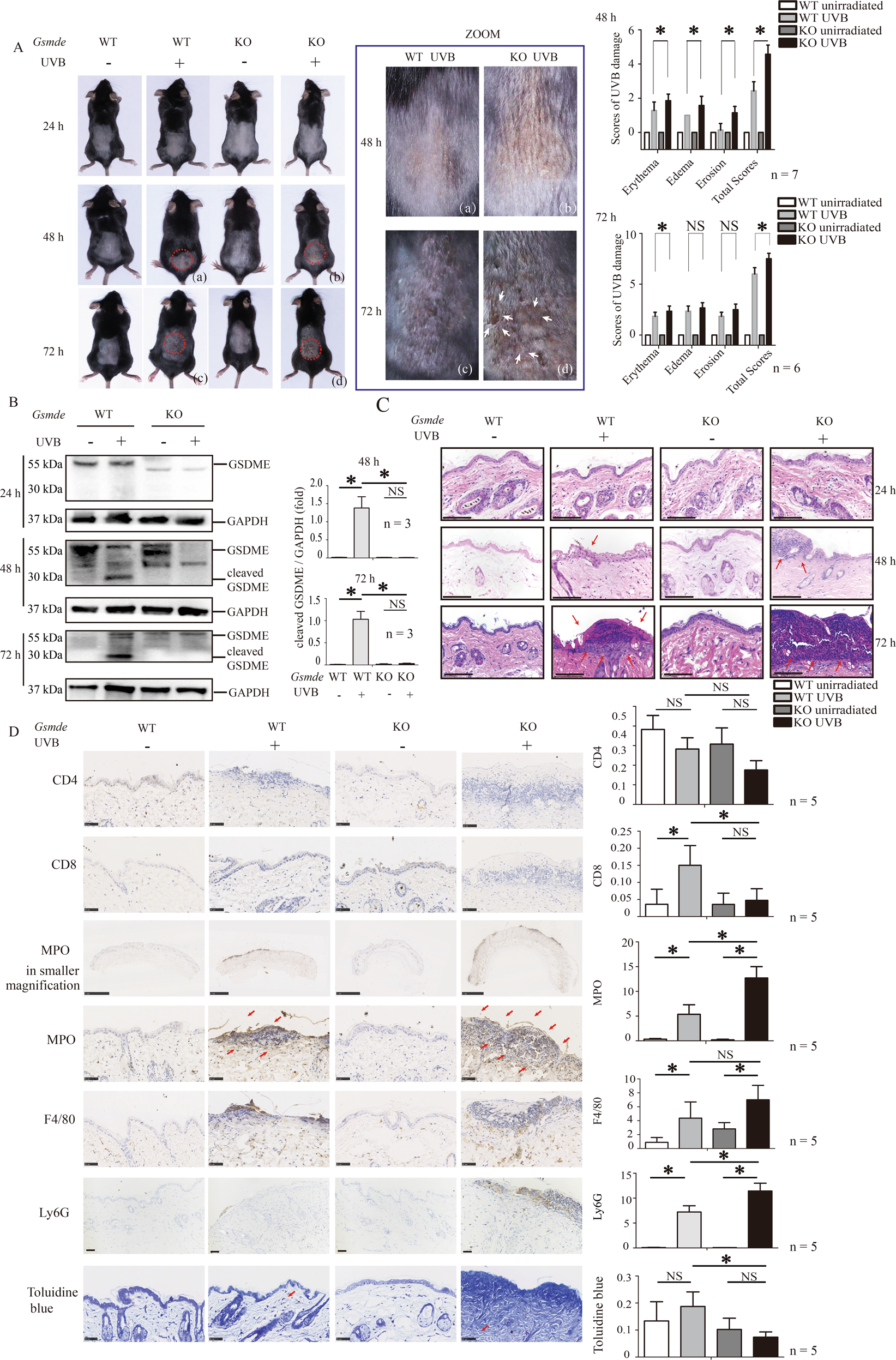 Fig. 1: Gsdme−/− mice present aggravated skin inflammation after UVB exposure.