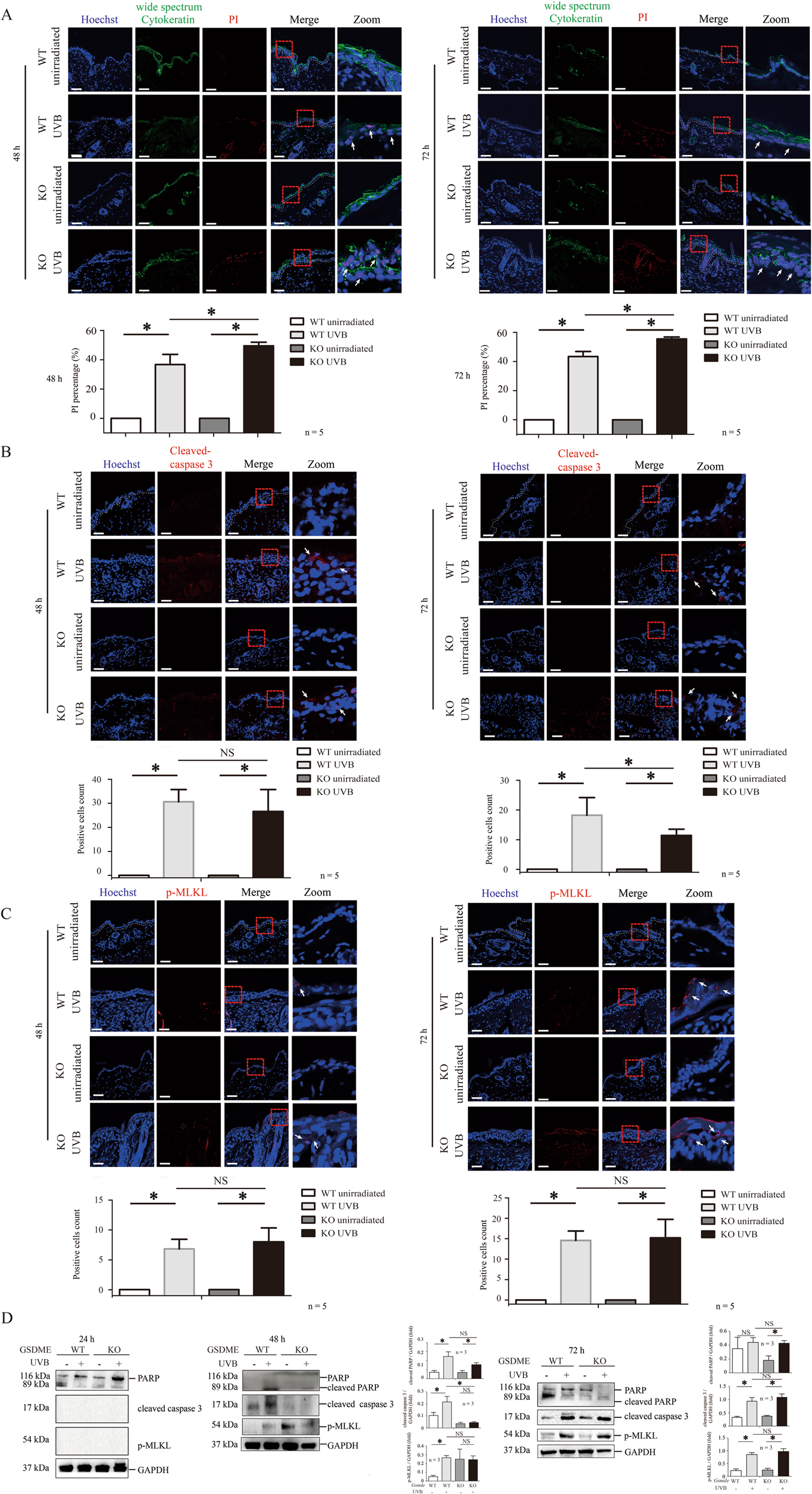 Fig. 2: Pyroptosis, apoptosis, and necroptosis were triggered simultaneously in UVB-challenged mice.