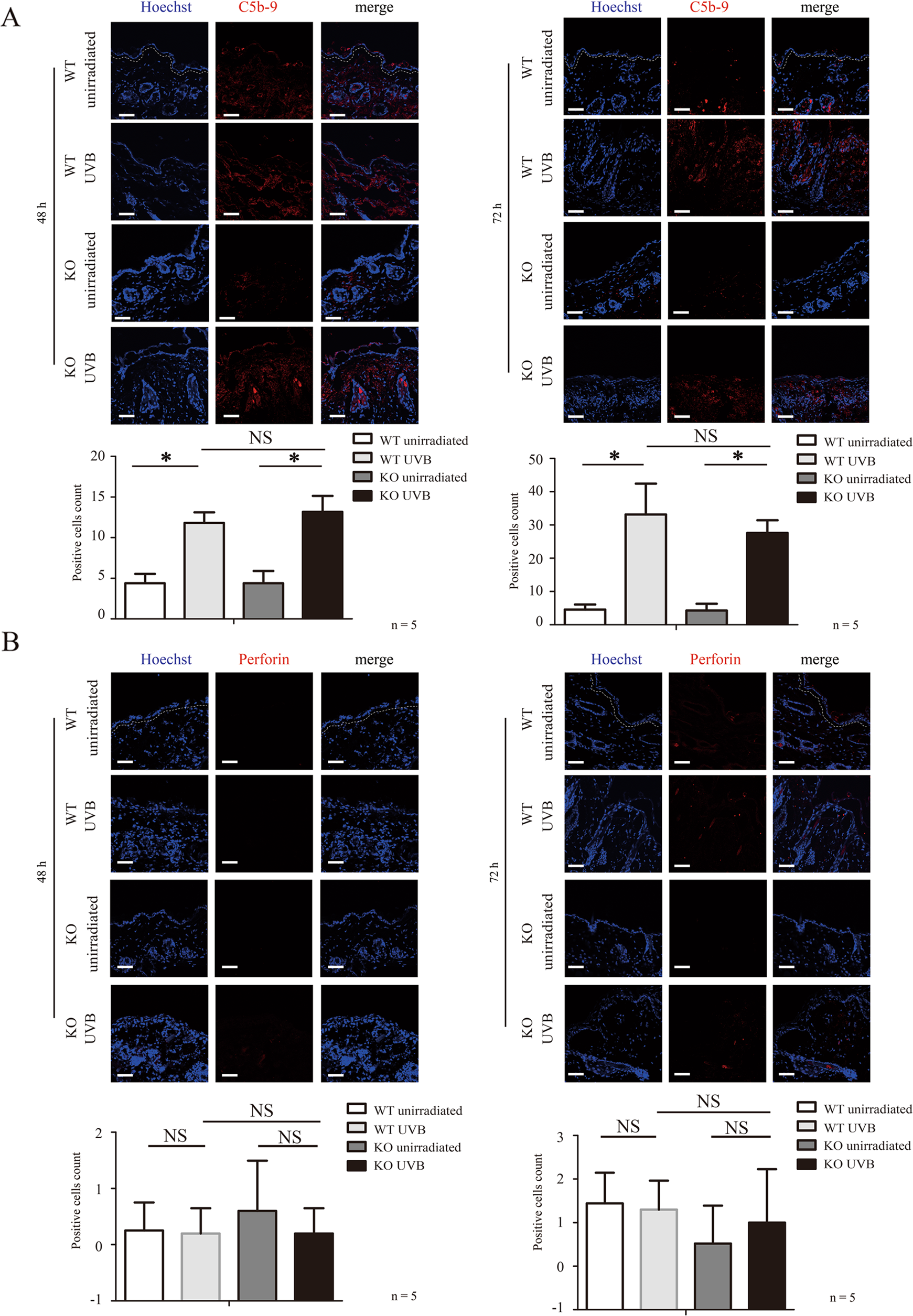 Fig. 3: Membrane attack complex C5b-9 and perforin do not contribute to the increase of keratinocyte death of UVB-challenged Gsdme−/− mice.