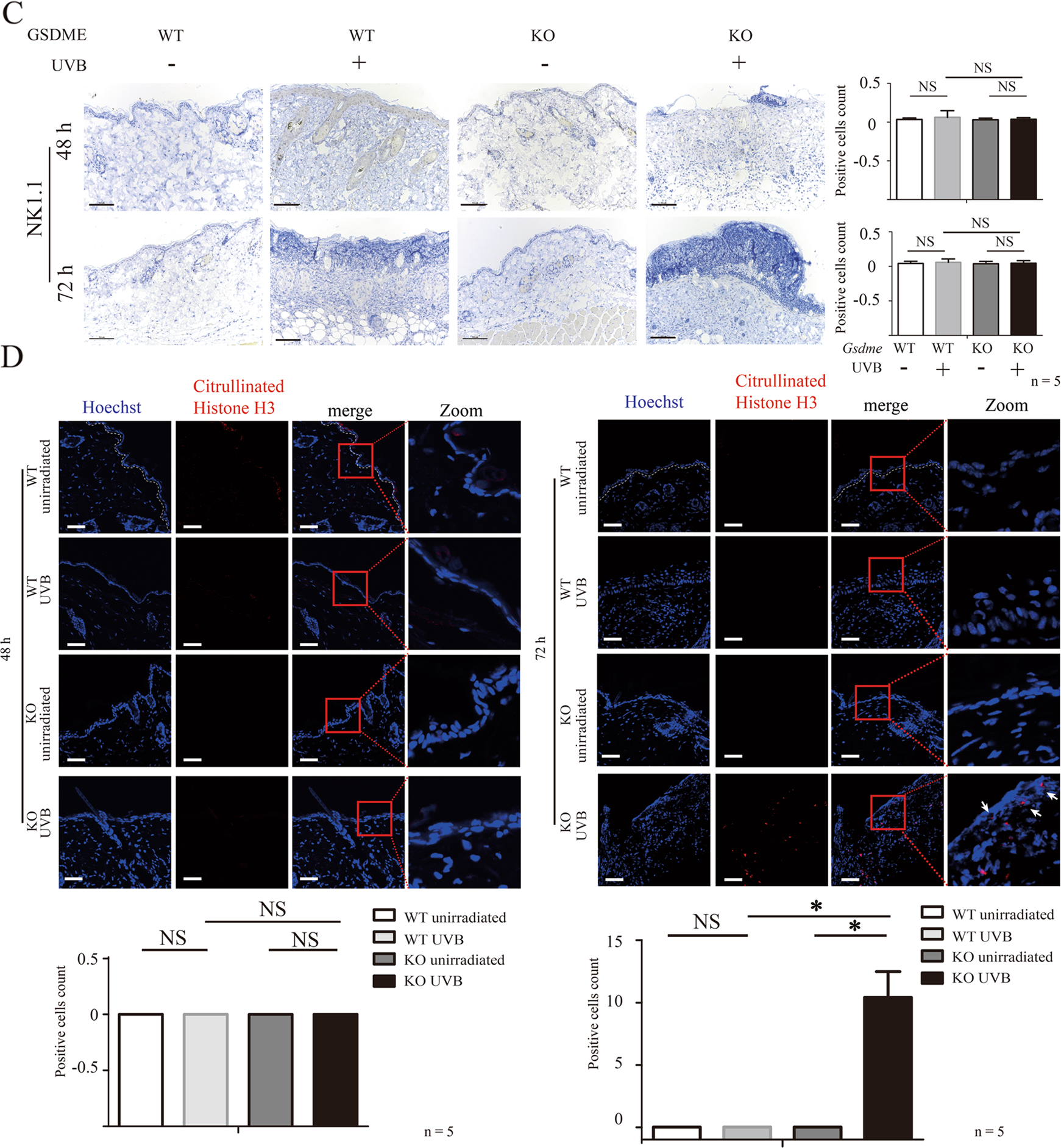 Fig. 3: Membrane attack complex C5b-9 and perforin do not contribute to the increase of keratinocyte death of UVB-challenged Gsdme−/− mice.
