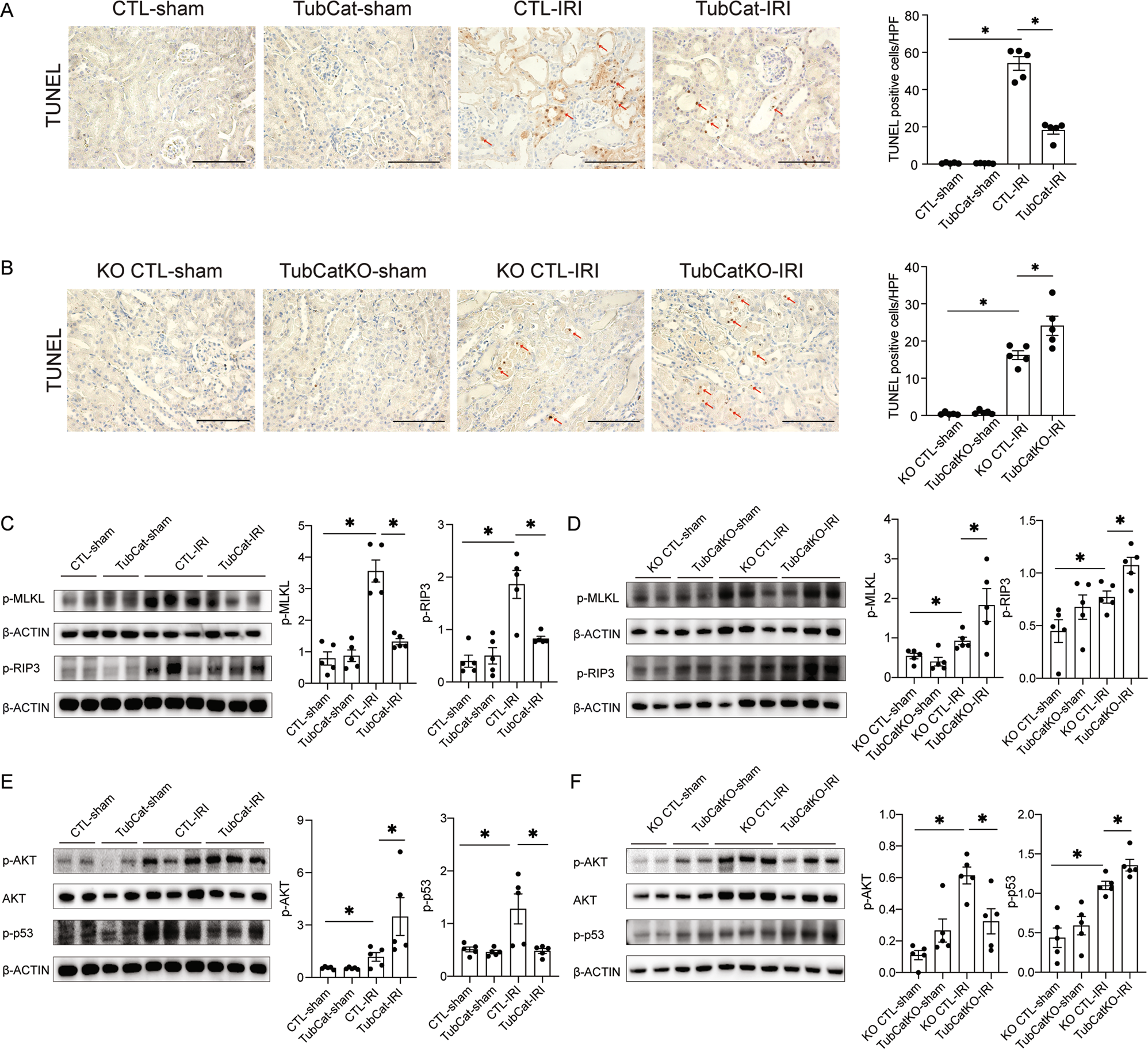 Fig. 3: β-catenin reduces kidney cell death in IRI-induced AKI via AKT/p53 signaling.