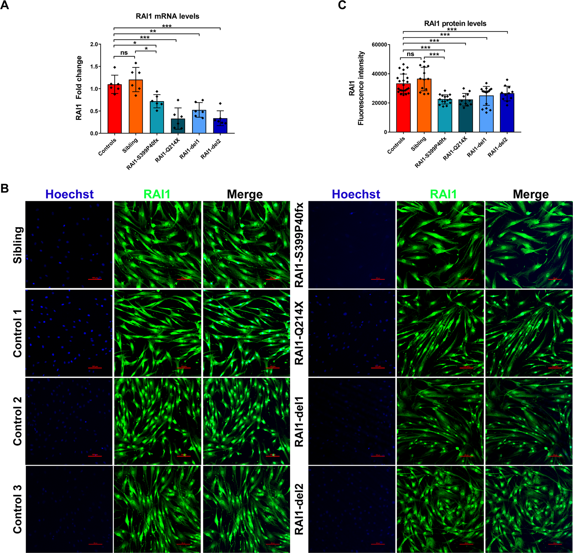 Fig. 1: Subcellular localization of RAI1 in SMS patient-derived cells.