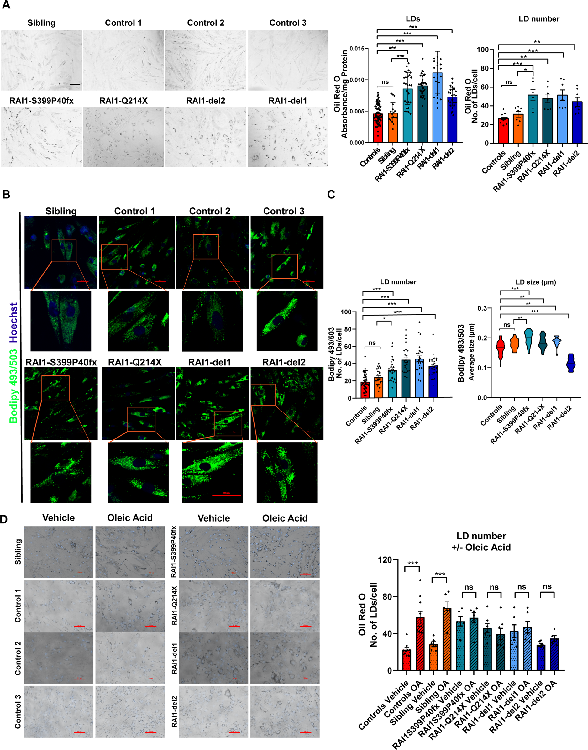 Fig. 4: Accumulation of lipid droplets in SMS patient-derived cells.