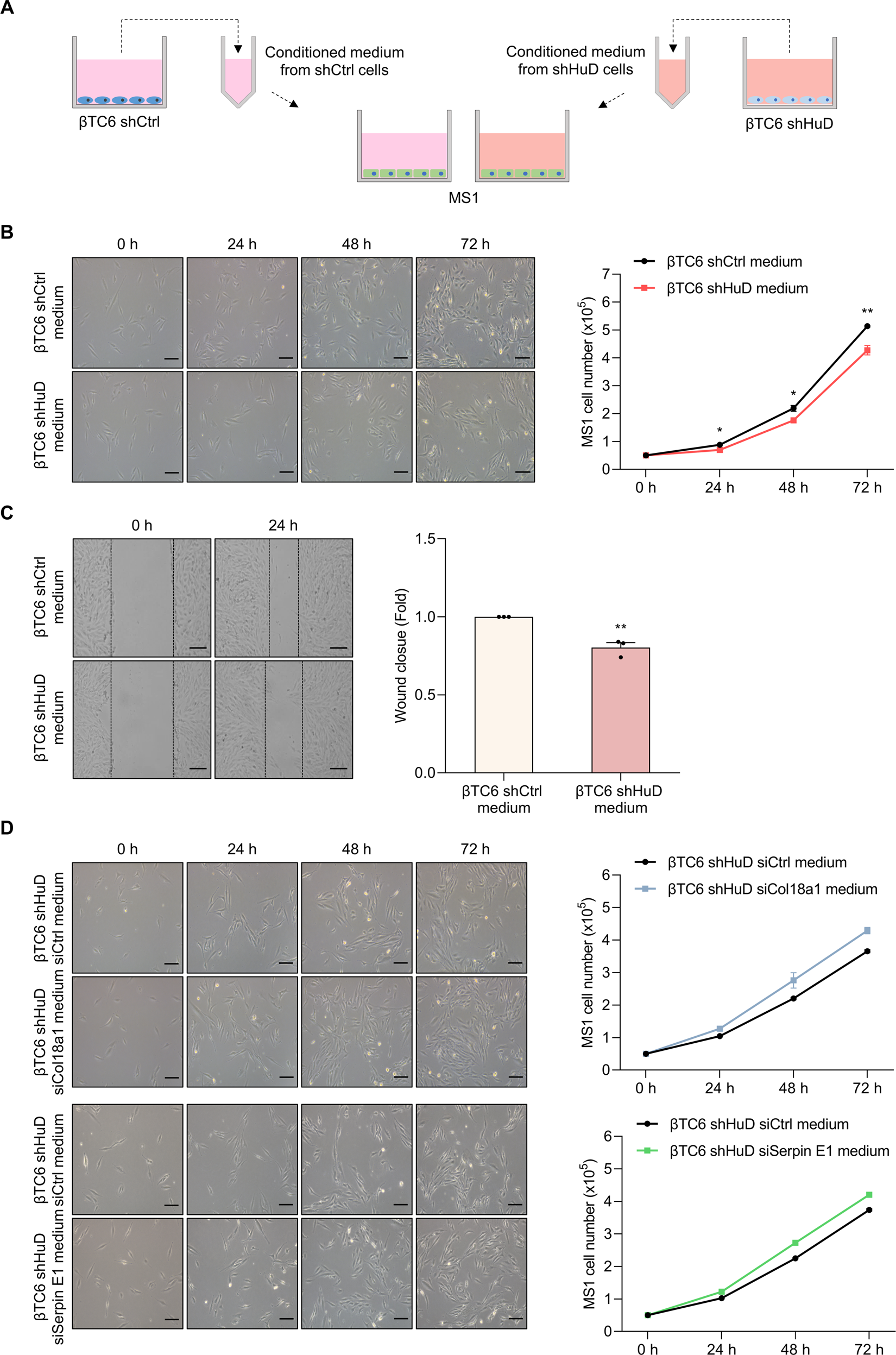 Fig. 6: The conditioned medium from βTC6 shHuD cells decreases the growth and migration of MS1 cells.