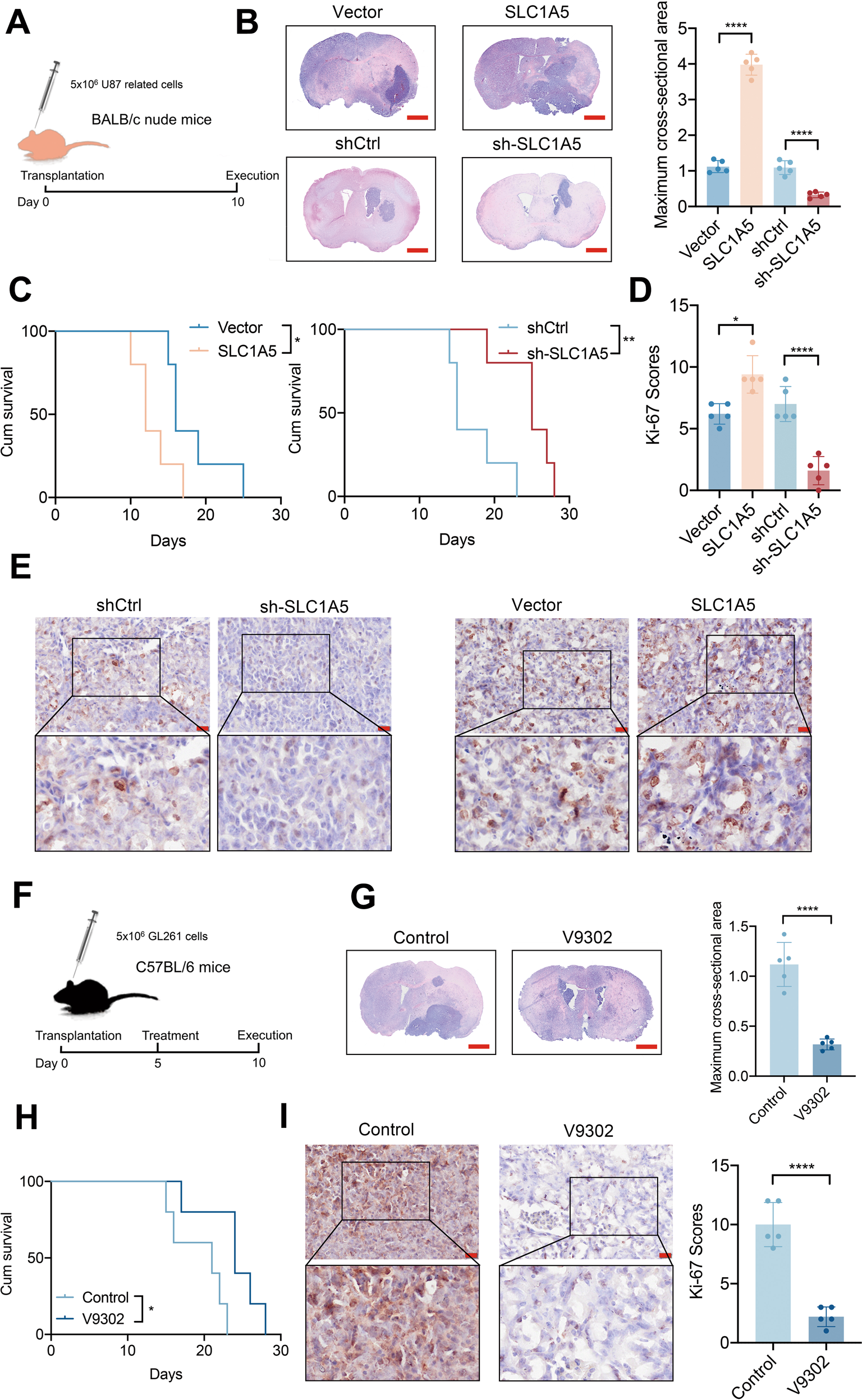Fig. 4: SLC1A5 modulated the glioma growth in vivo.