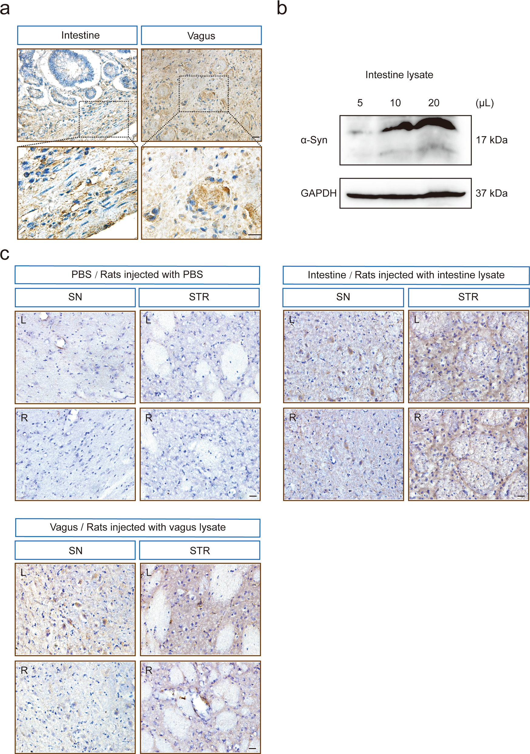 Fig. 2: Human α-syn expression in the rats injected with intestine or vagus lysate derived from a PD patient.