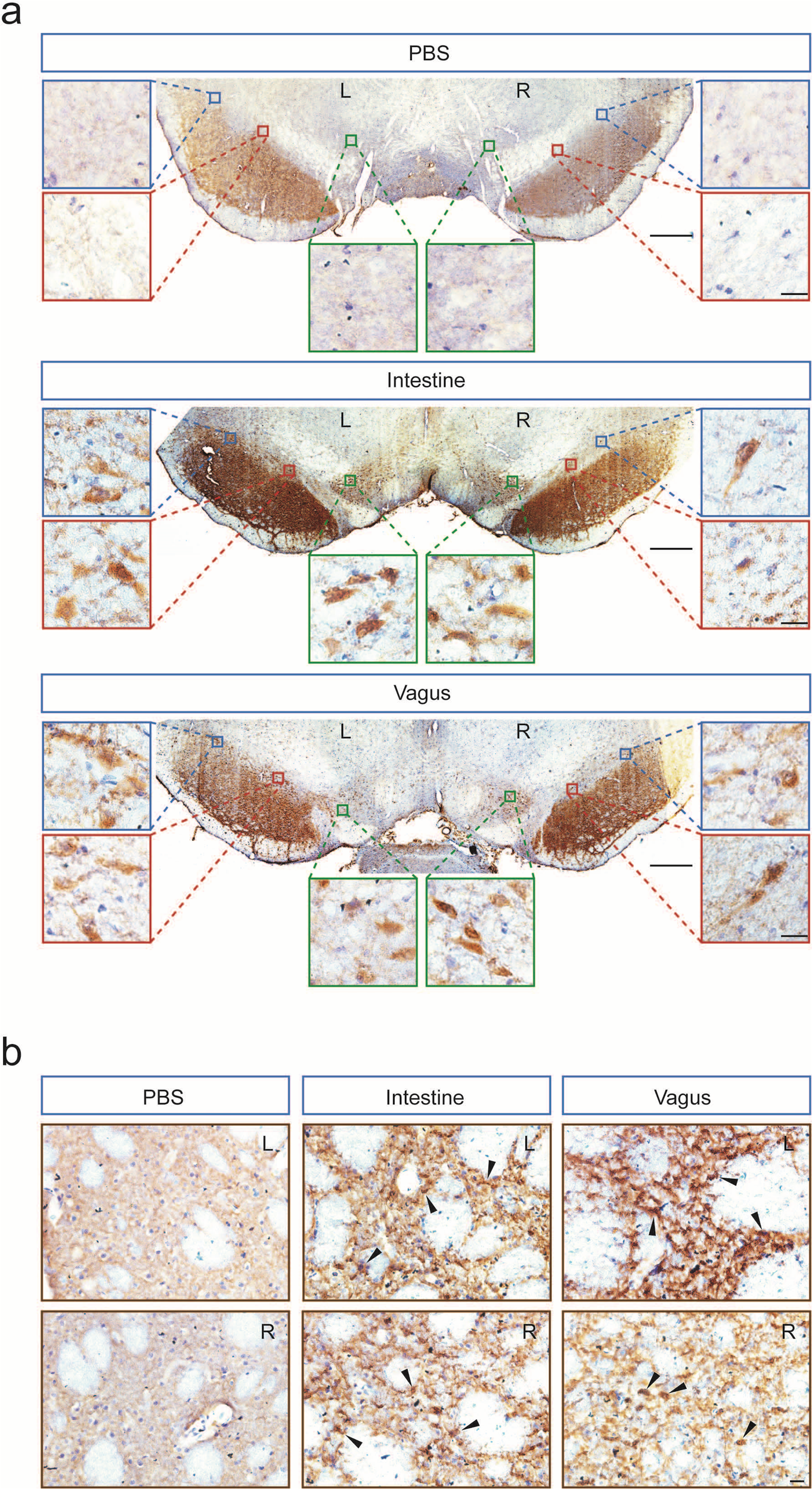 Fig. 3: Increased somatic accumulation of α-syn in the rats injected with intestine or vagus lysate.