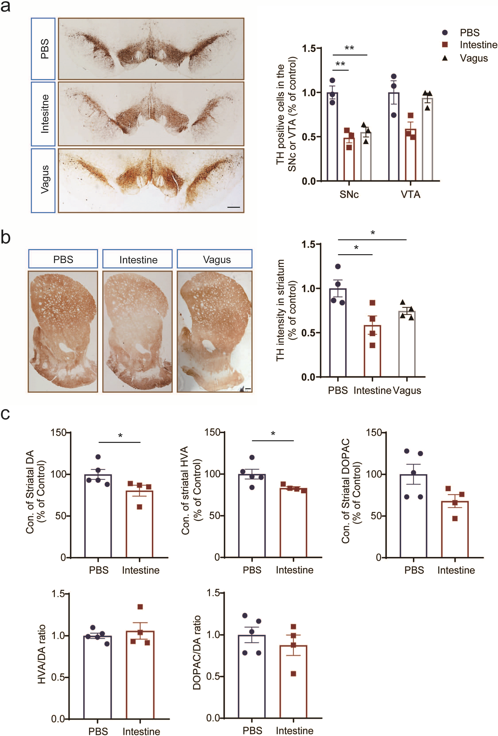 Fig. 4: The mesodiencephalic dopaminergic neuronal loss and profound fiber pathology in the rats injected with intestine or vagus lysate.