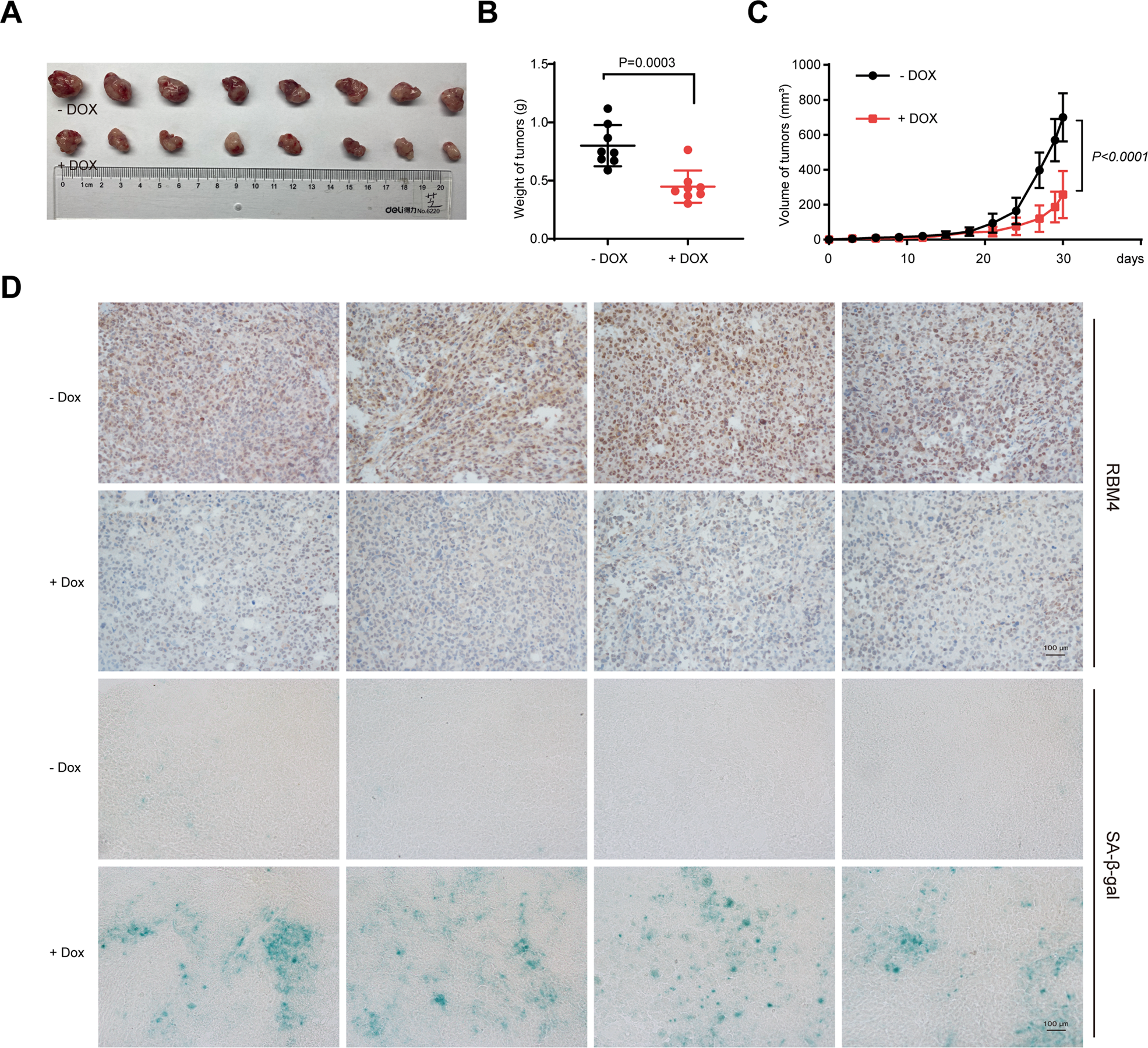 Fig. 3: RBM4 depletion promotes senescence to suppress cancer progression in vivo.
