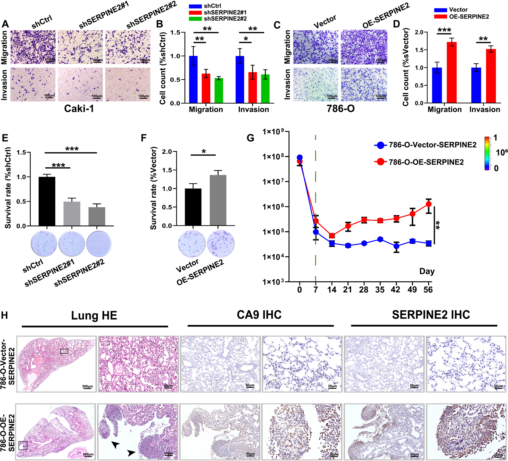 Fig. 5: SERPINE2 promotes ccRCC progression, accompanied by EMT.