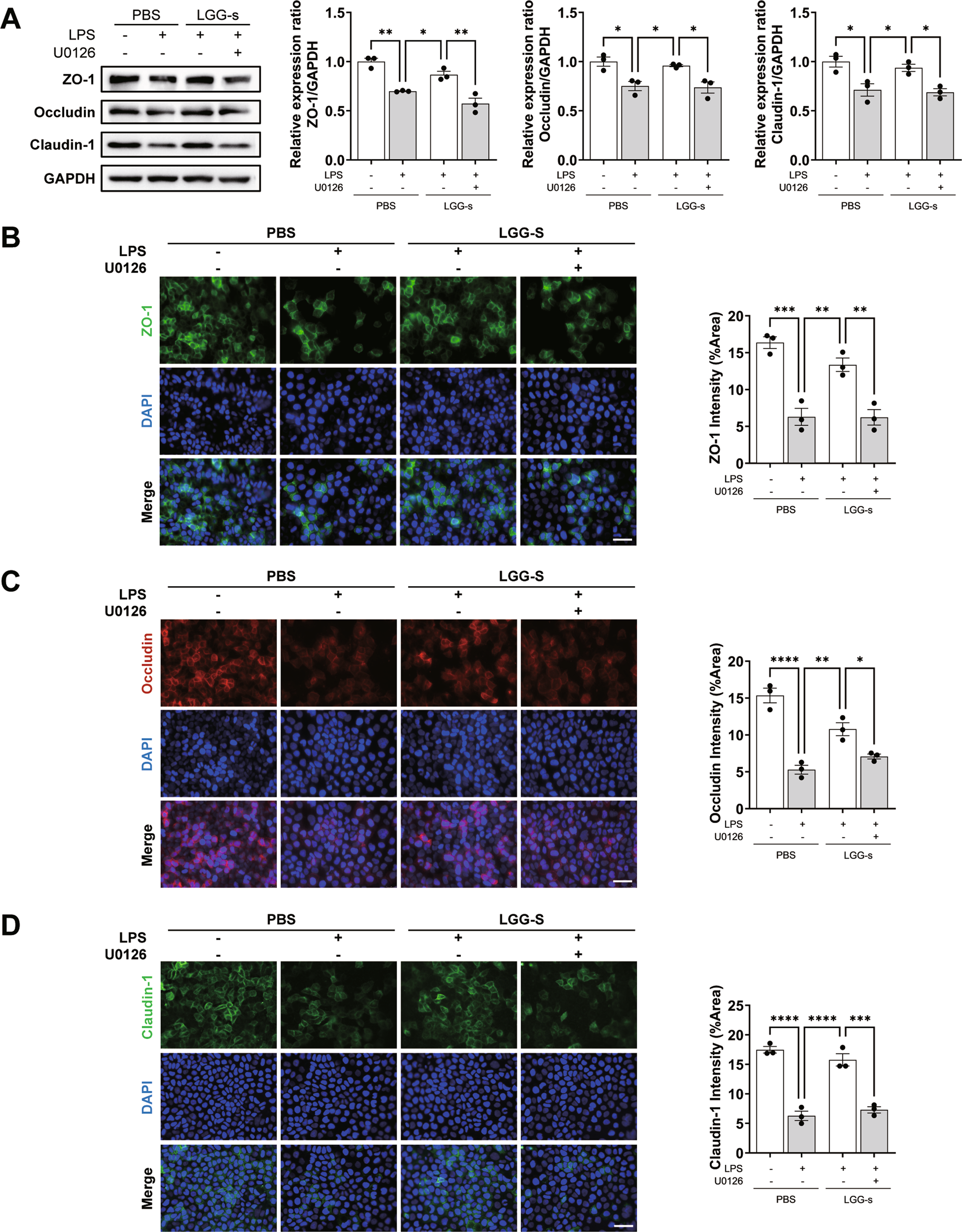 Fig. 7: LGG-s lost the improvement of barrier function after MEK inhibition.