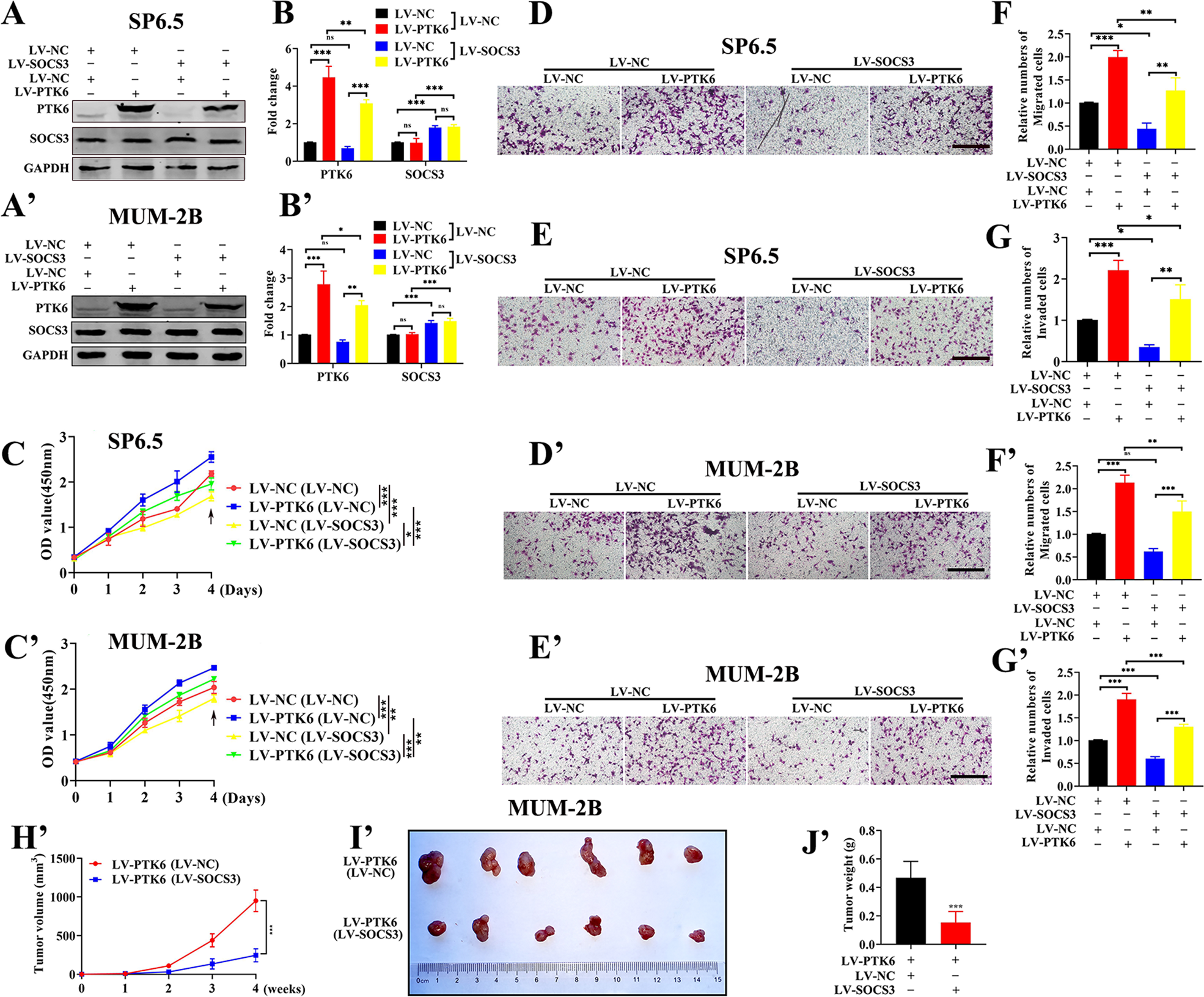 Fig. 7: Overexpressing SOCS3 can partially attenuate the PTK6-induced promotion of UM cell proliferation, migration, and invasion in vitro and in vivo.