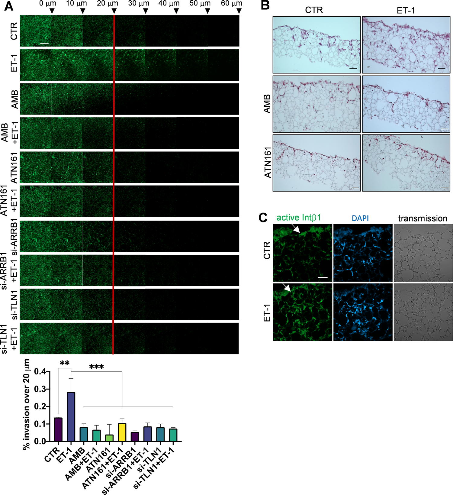 Fig. 7: HG-SOC invasion is regulated by ET-1/Intβ1 signaling.