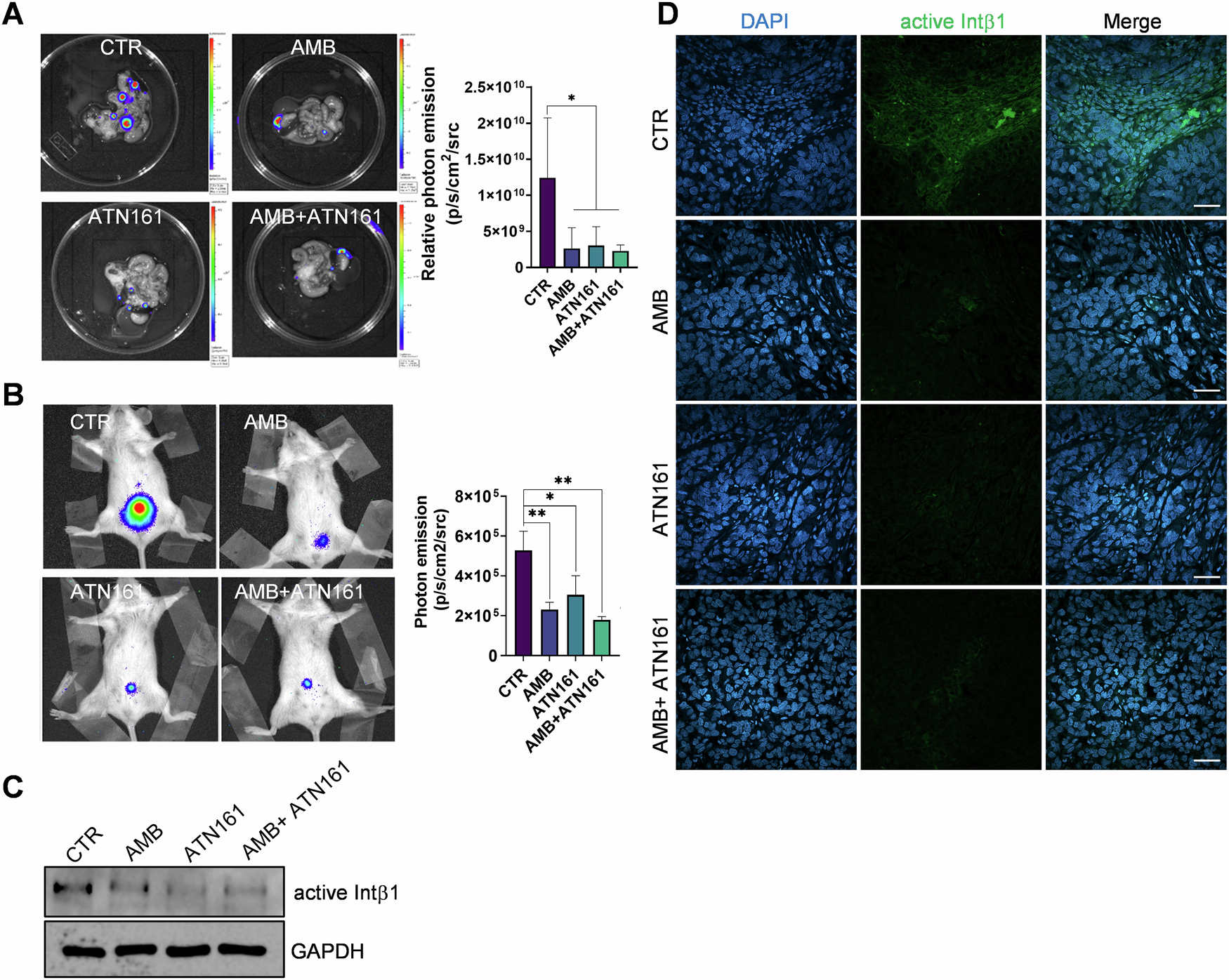 Fig. 8: Ambrisentan as well as ATN161 controls SOC cell metastatic colonization .