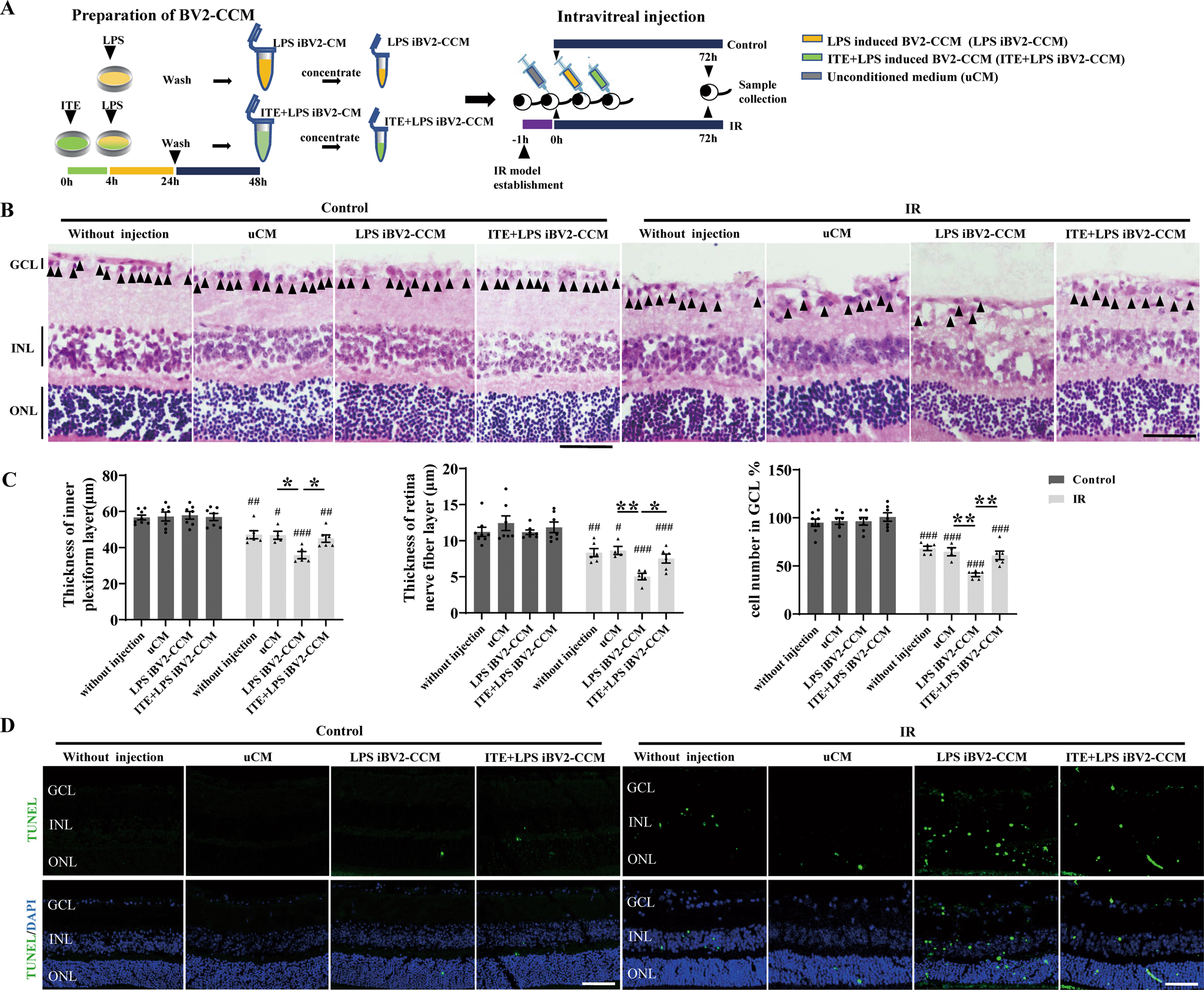 Fig. 5: ITE conferred retinal protection against microglia derived toxins induced by LPS in retinal IR injury.