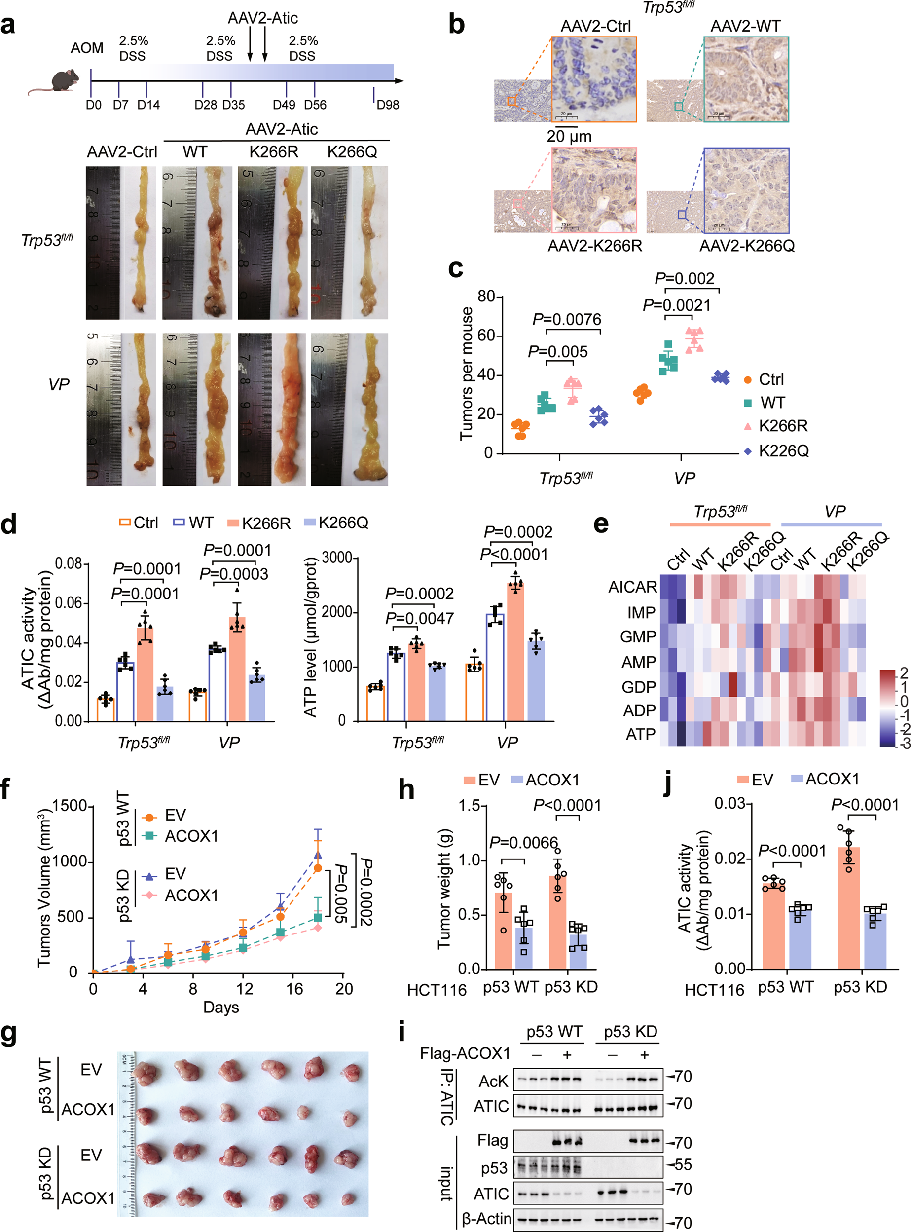 Fig. 5: Acetylation of ATIC is closely correlated to colorectal tumorigenesis.
