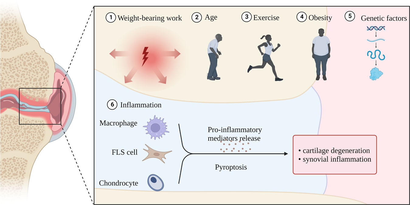 Fig. 7: Pyroptosis and OA: Etiologies of OA include age, inflammation, obesity, weight-bearing work, exercise, and genetic factors.