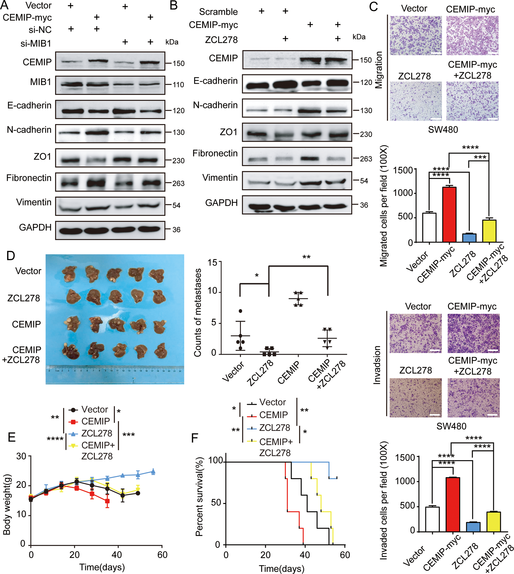 Fig. 6: CEMIP promotes metastasis of CRC cells through GRAF1/CDC42/MAPK pathway-regulated EMT.