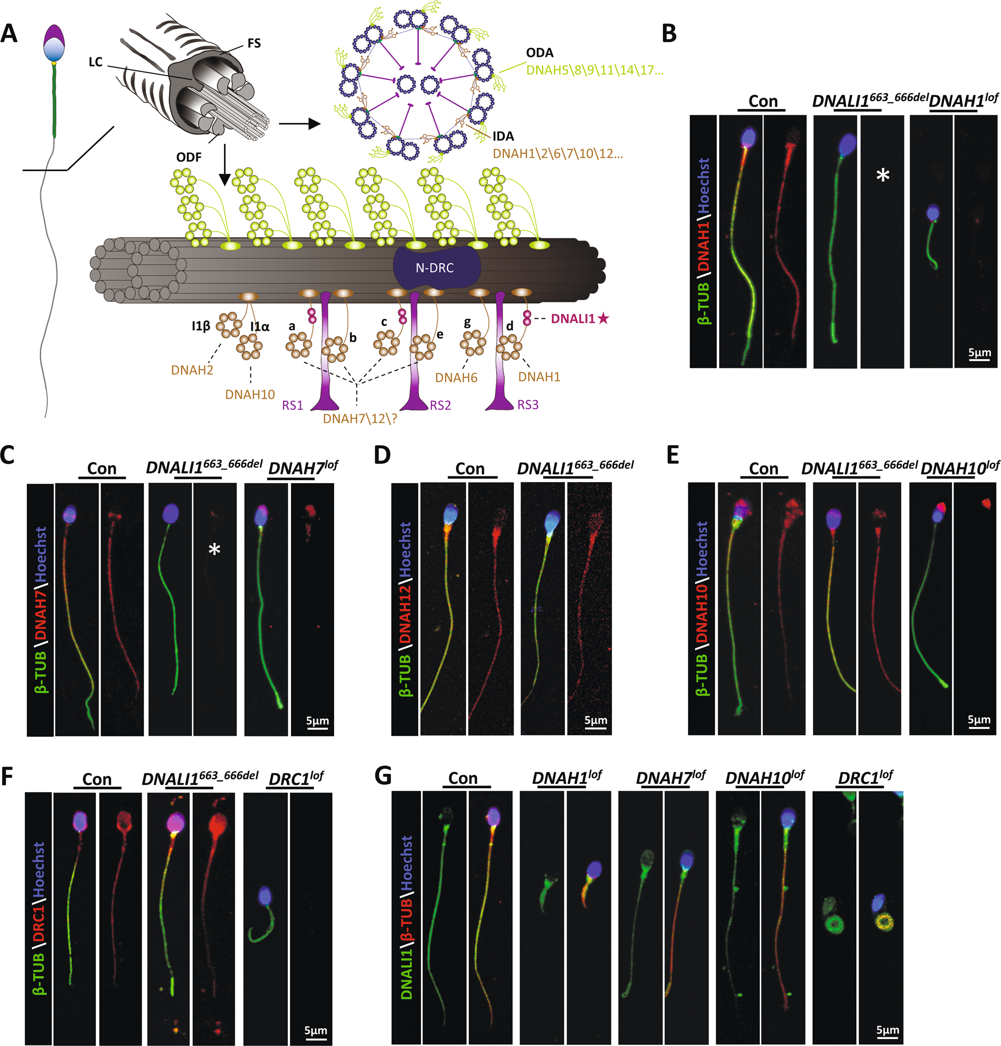 Fig. 2: Location of IDA components in the human flagellum.