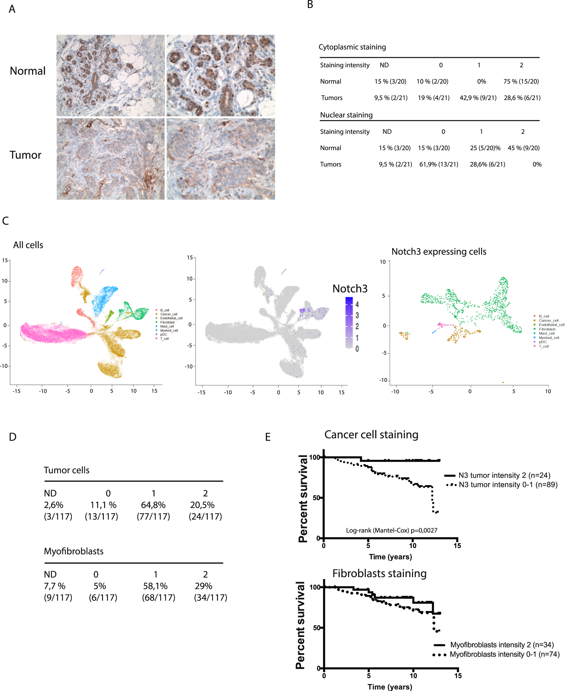 Fig. 1: Notch3 is lost and of good prognosis in breast cancers.