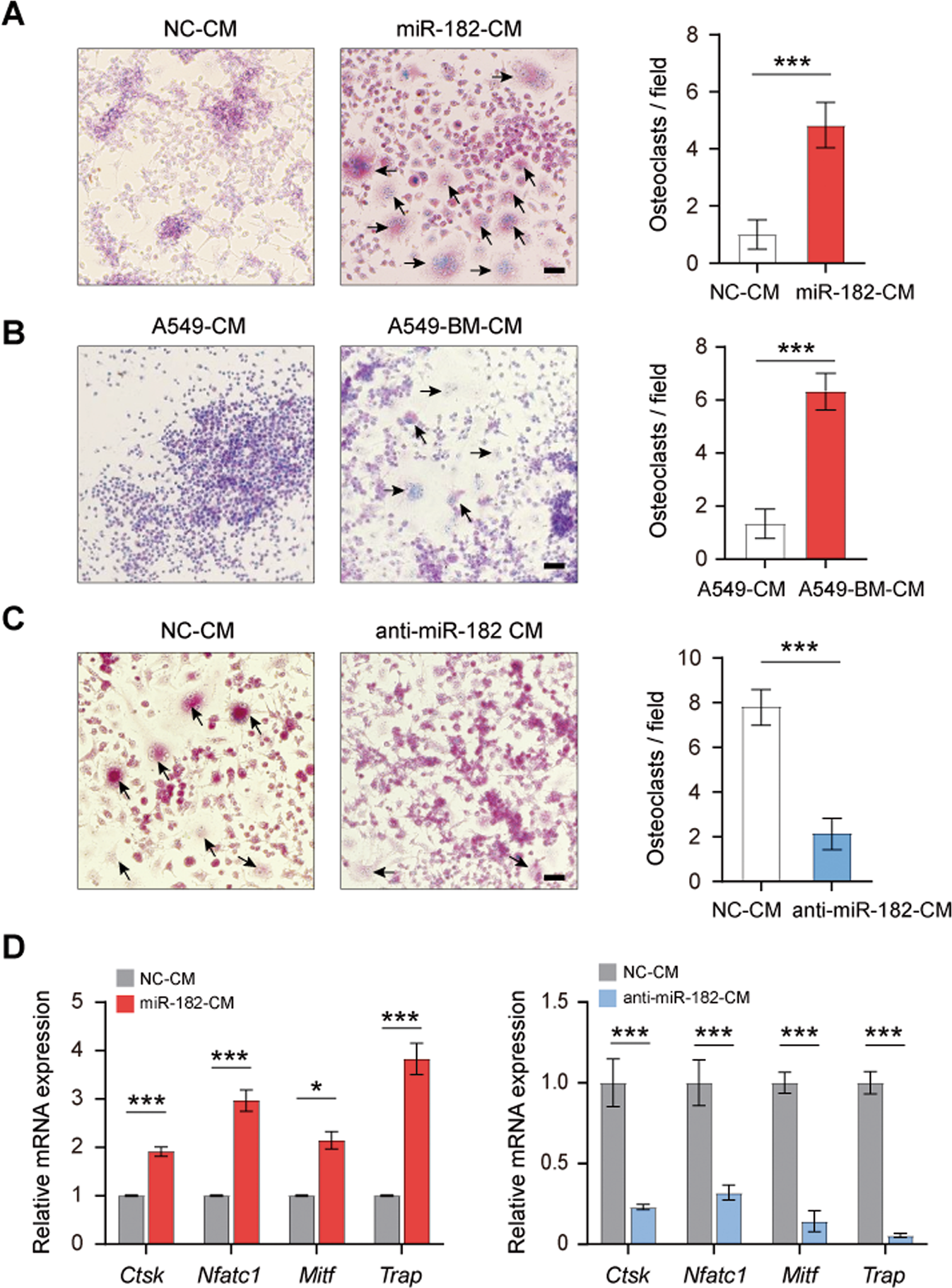 Fig. 3: Conditioned media (CM) from miR-182-upregulated NSCLC cells promotes osteoclast precursor cell differentiation.