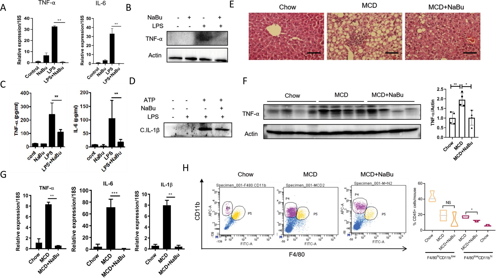 Fig. 1: NaBu attenuates LM activation in NASH.