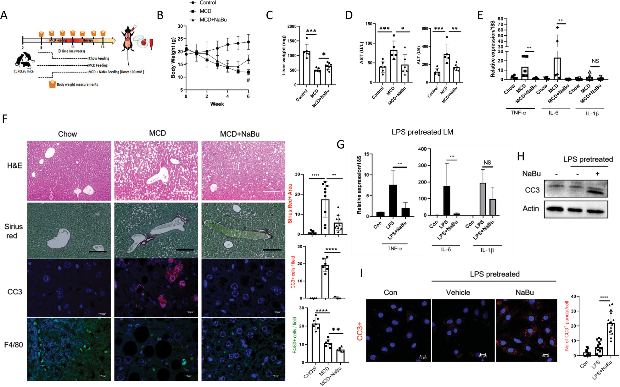 Fig. 6: NaBu treatment reverses hallmarks of NASH.