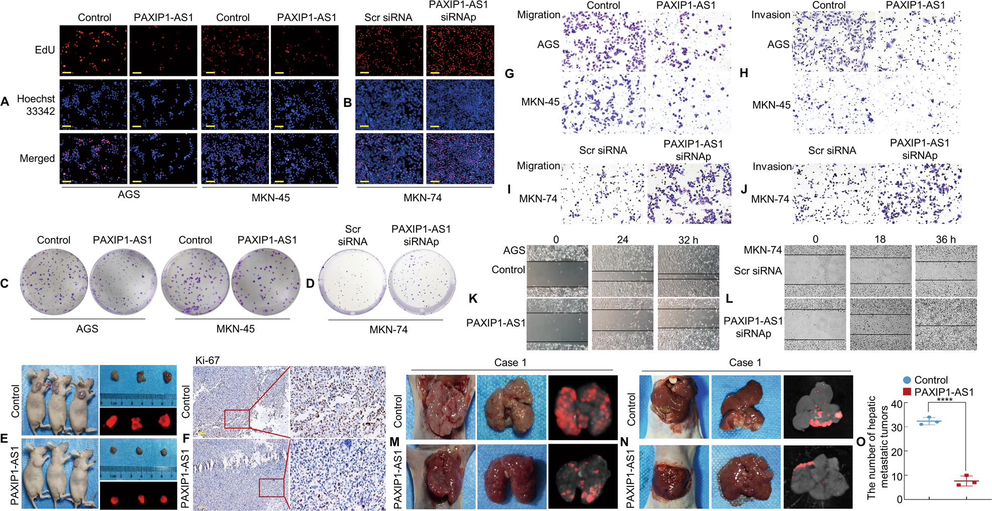 Fig. 3: Forced expression of PAXIP1-AS1 inhibits GC cell proliferation and metastasis.