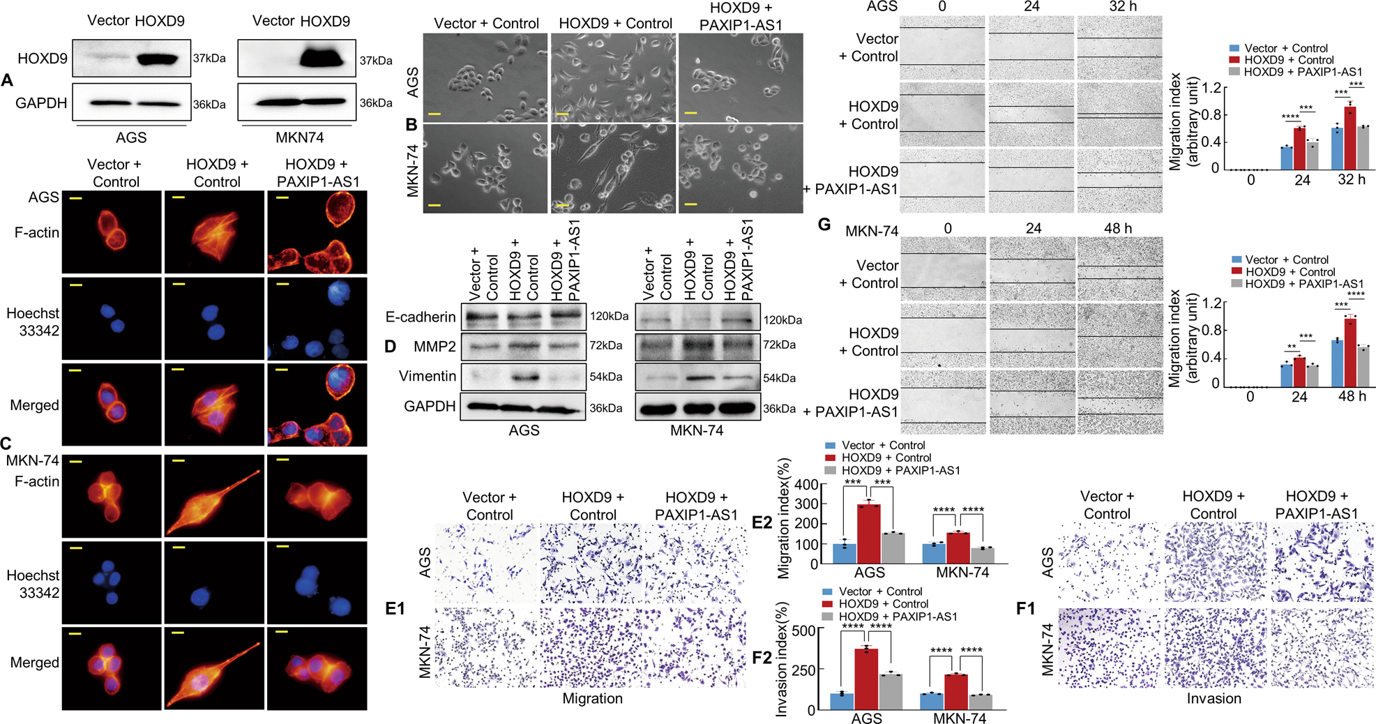 Fig. 4: HOXD9-PAXIP1-AS1 axis regulates the migration and invasion of GC cells in vitro.