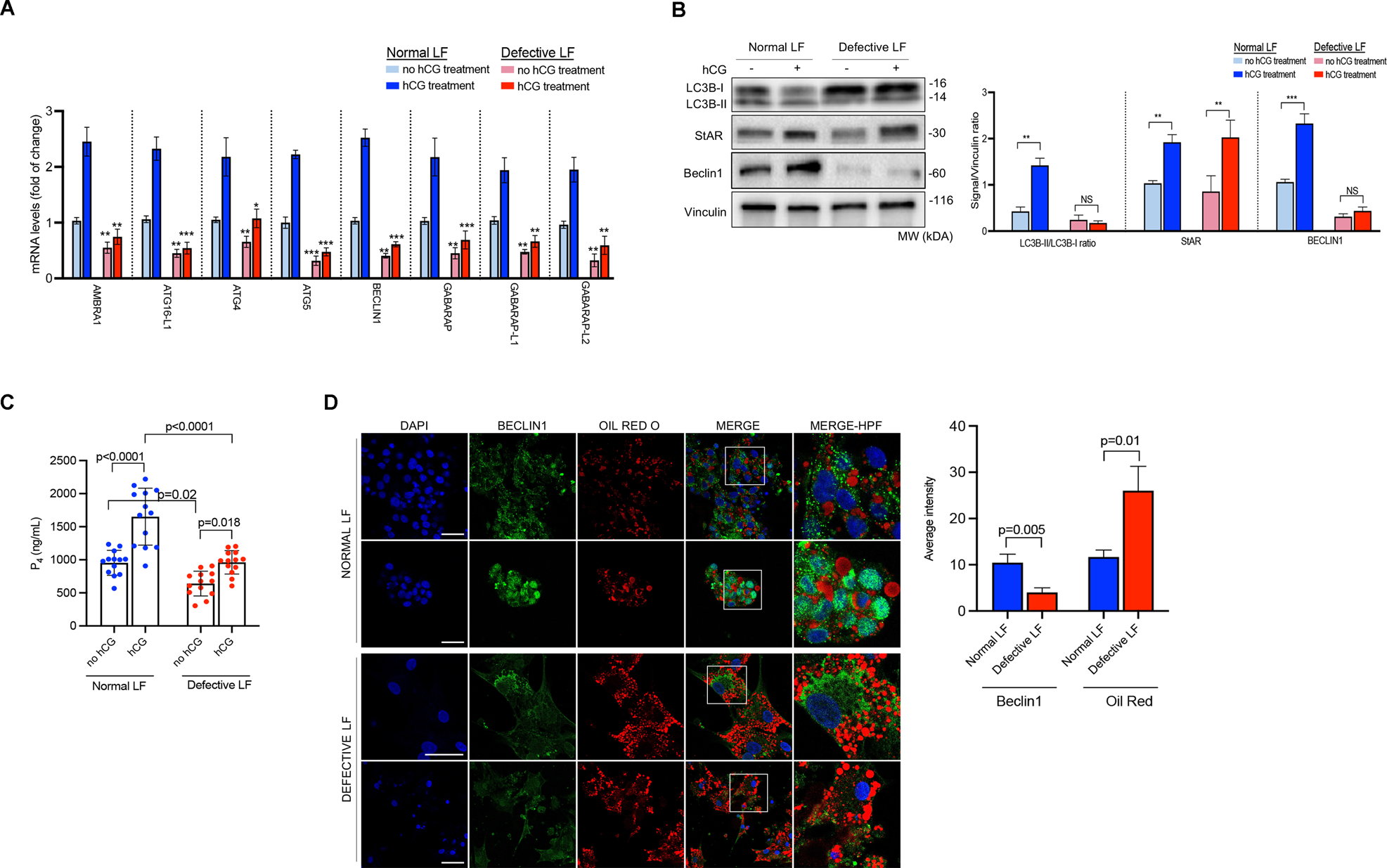 Fig. 7: Autophagic flux is compromised in patients with defective luteal function.