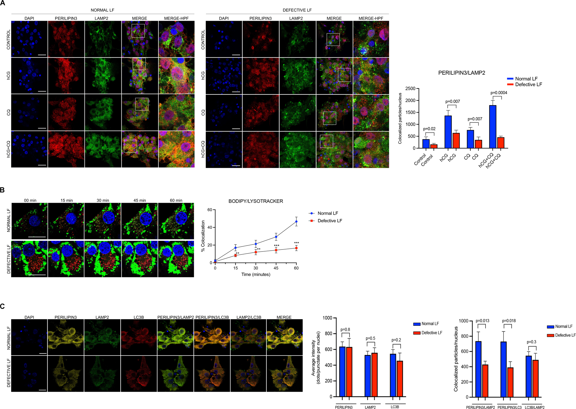 Fig. 8: Lipophagy-mediated steroidogenesis is perturbed in patients with defective luteal function (LF).