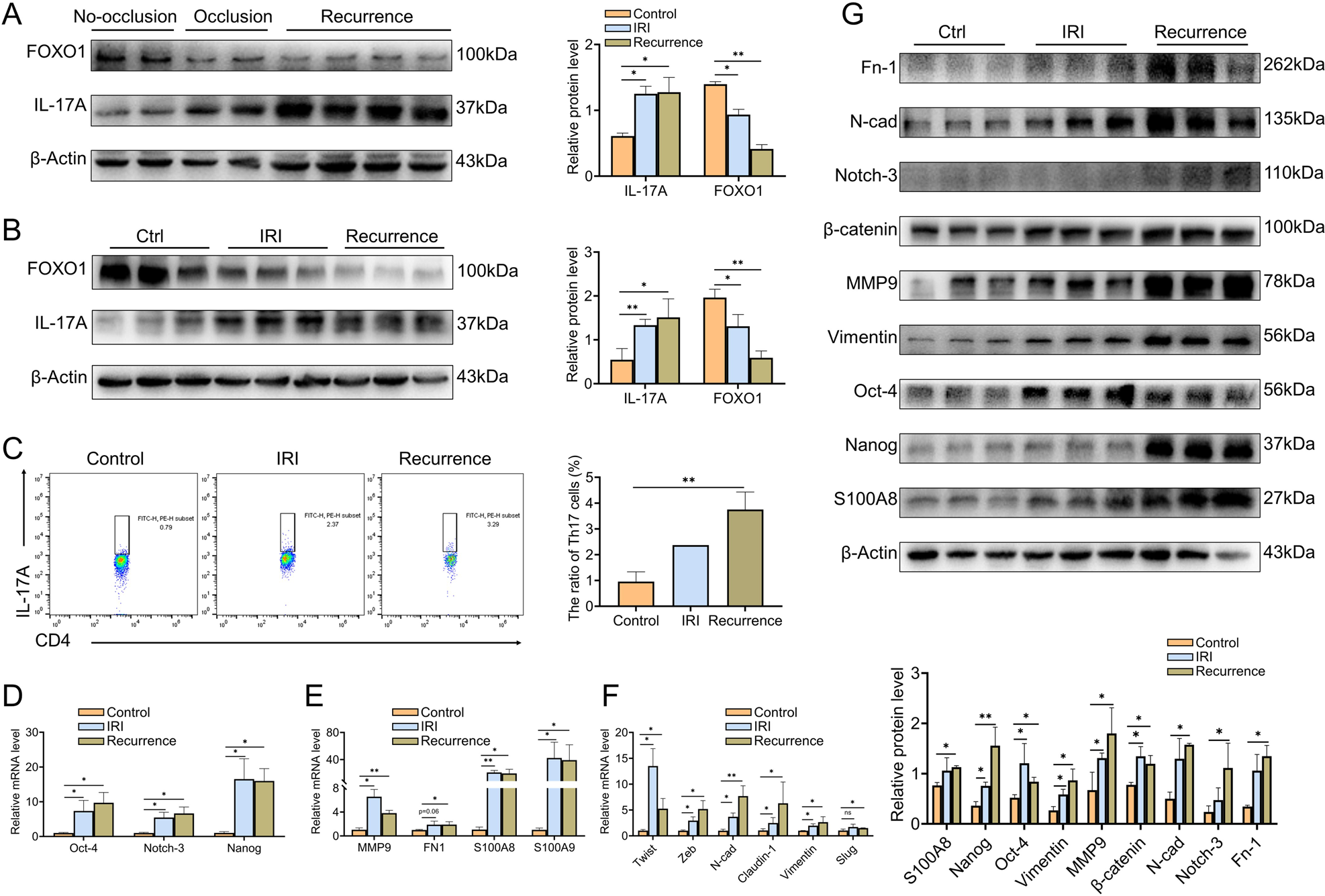 Fig. 6: The changes of the microenvironment in the liver with IRI and HCC recurrence.