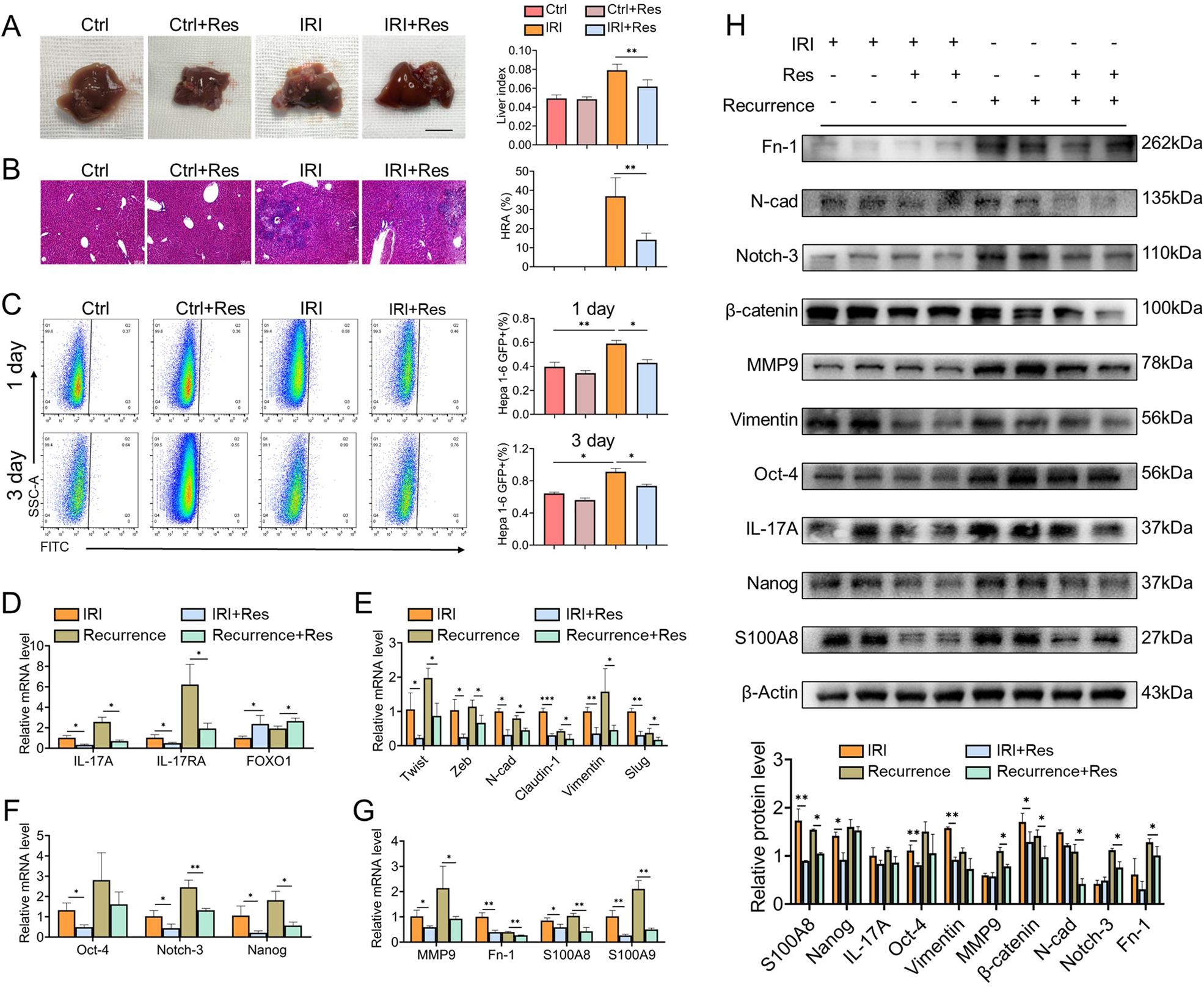 Fig. 7: Upregulation of FOXO1 ameliorates the microenvironment in liver IRI and reduces HCC recurrence.