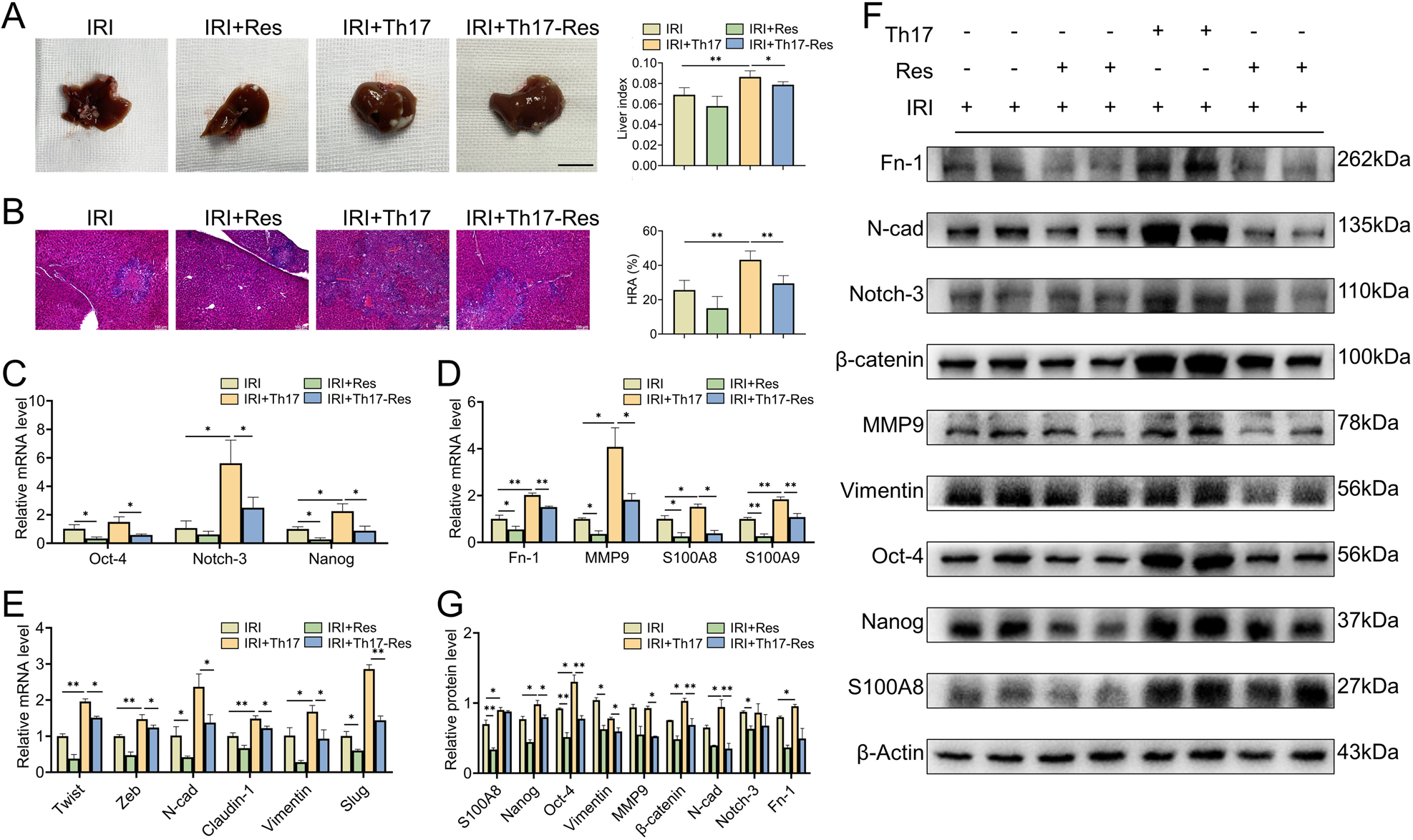 Fig. 9: Th17 cells promote HCC recurrence in vivo.