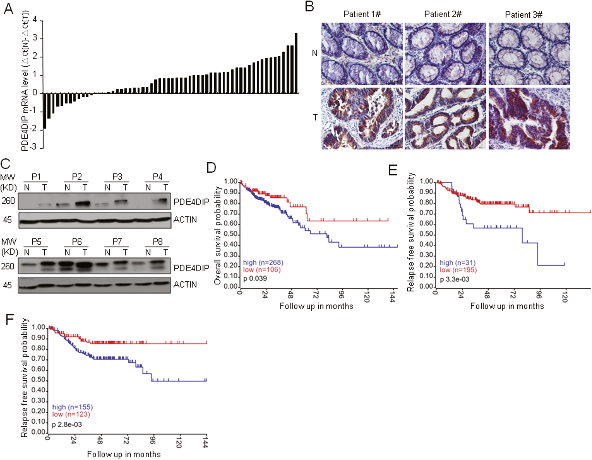 Fig. 1: The expression of PDE4DIP is upregulated in human CRC tissues and associated with poor survival of patients.