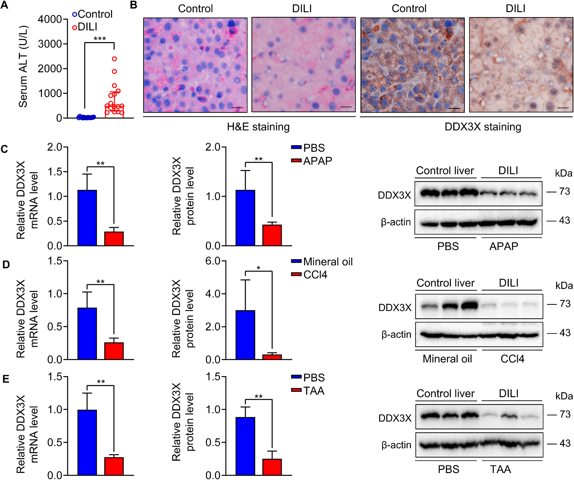 Fig. 1: DDX3X expression is decreased in the livers of humans and mice with DILI.