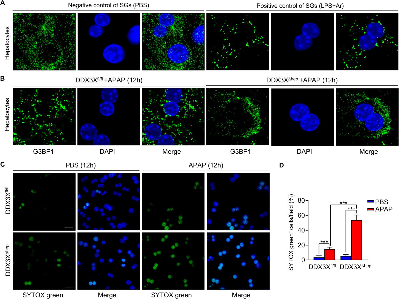 Fig. 4: Hepatocytes DDX3X is required for stress granules formation and cell survival in APAP-induced liver injury.
